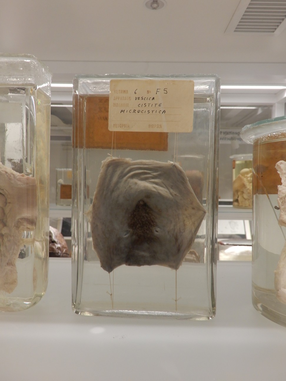 singolo reperto antropologico, preparato anatomico (morfologia alterata per patologia) (XIX-XX)