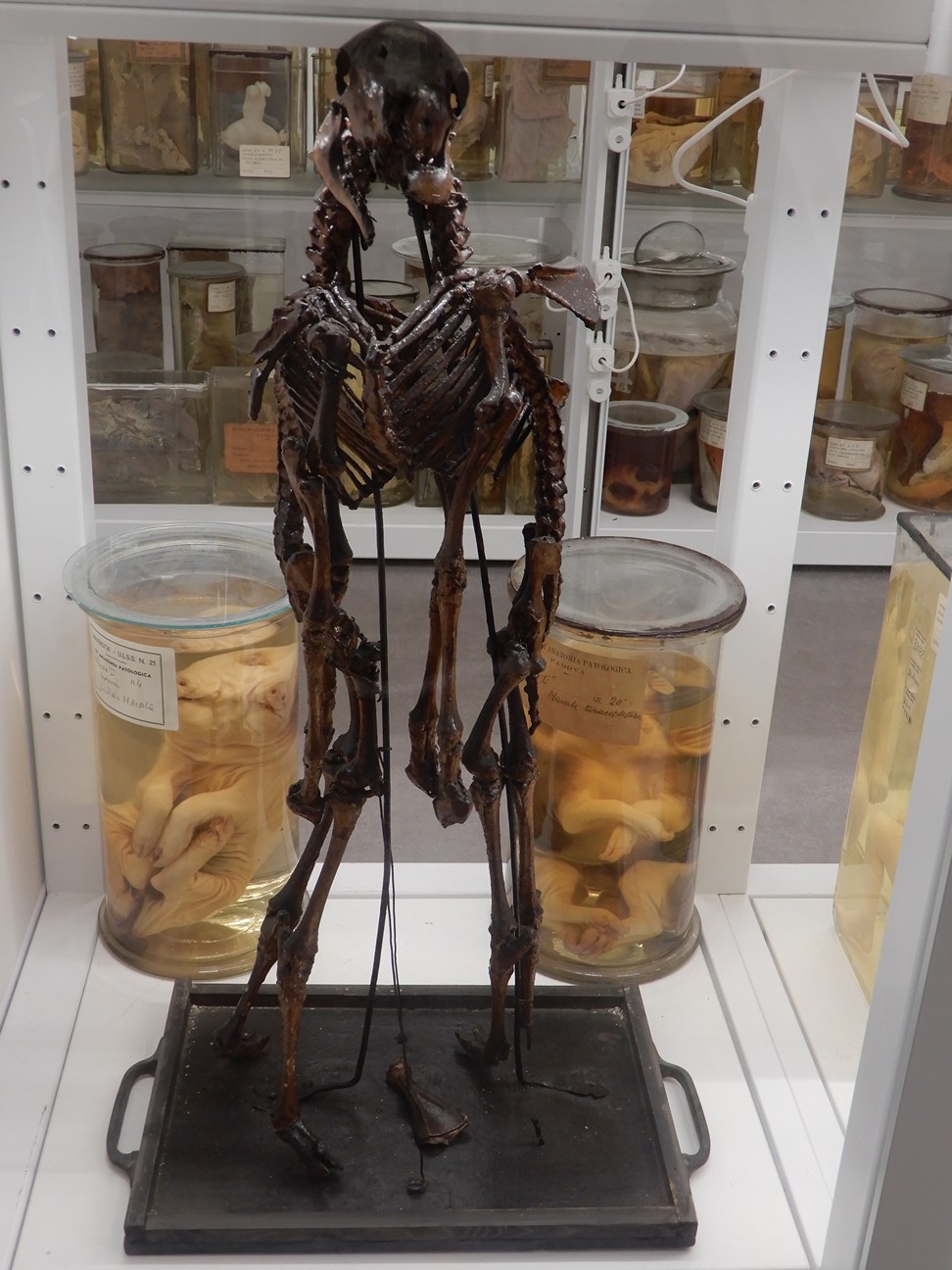 singolo reperto antropologico, preparato anatomico (morfologia alterata per patologia) (XIX-XX)