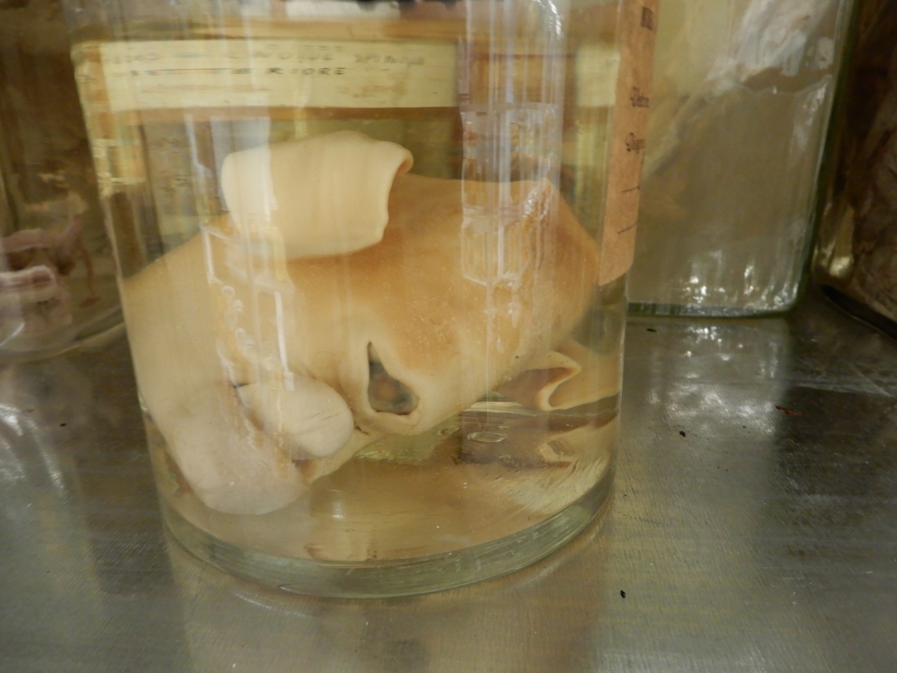 singolo reperto antropologico, preparato anatomico (morfologia alterata per patologia) (XIX-XX)