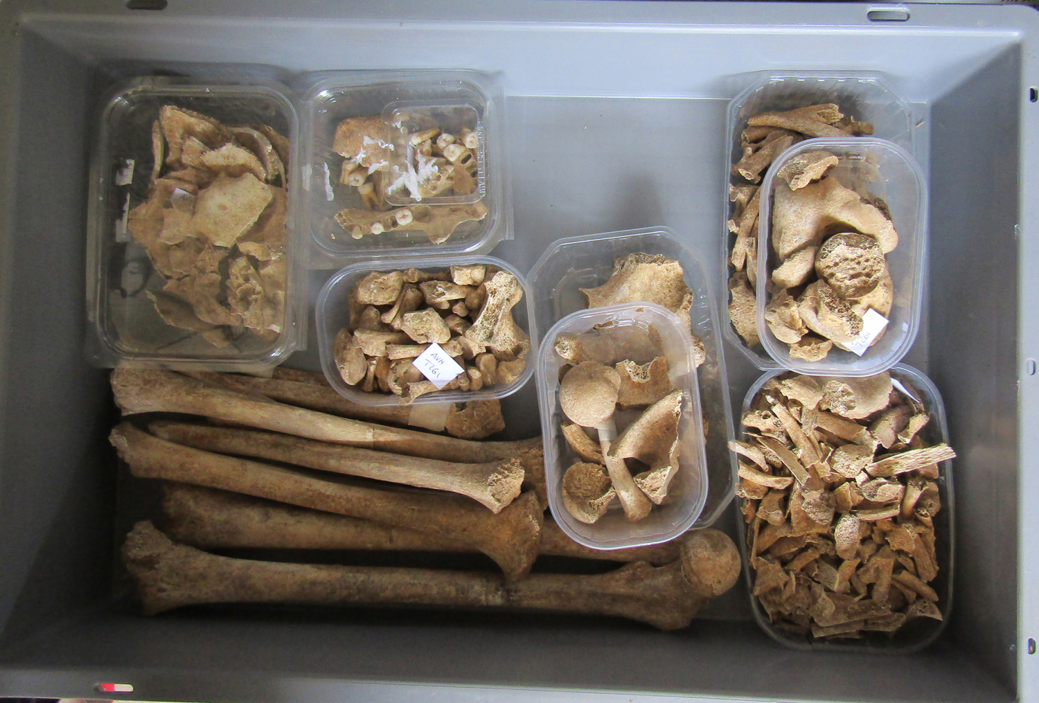 reperti antropologici pertinenti a un unico individuo, reperto osteo dentario (morfologia naturale) (SECOLI/ I - III AD)