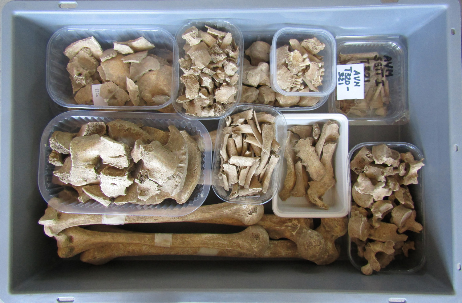 reperti antropologici pertinenti a un unico individuo, reperto osteo dentario (morfologia naturale) (SECOLI/ I - III AD)
