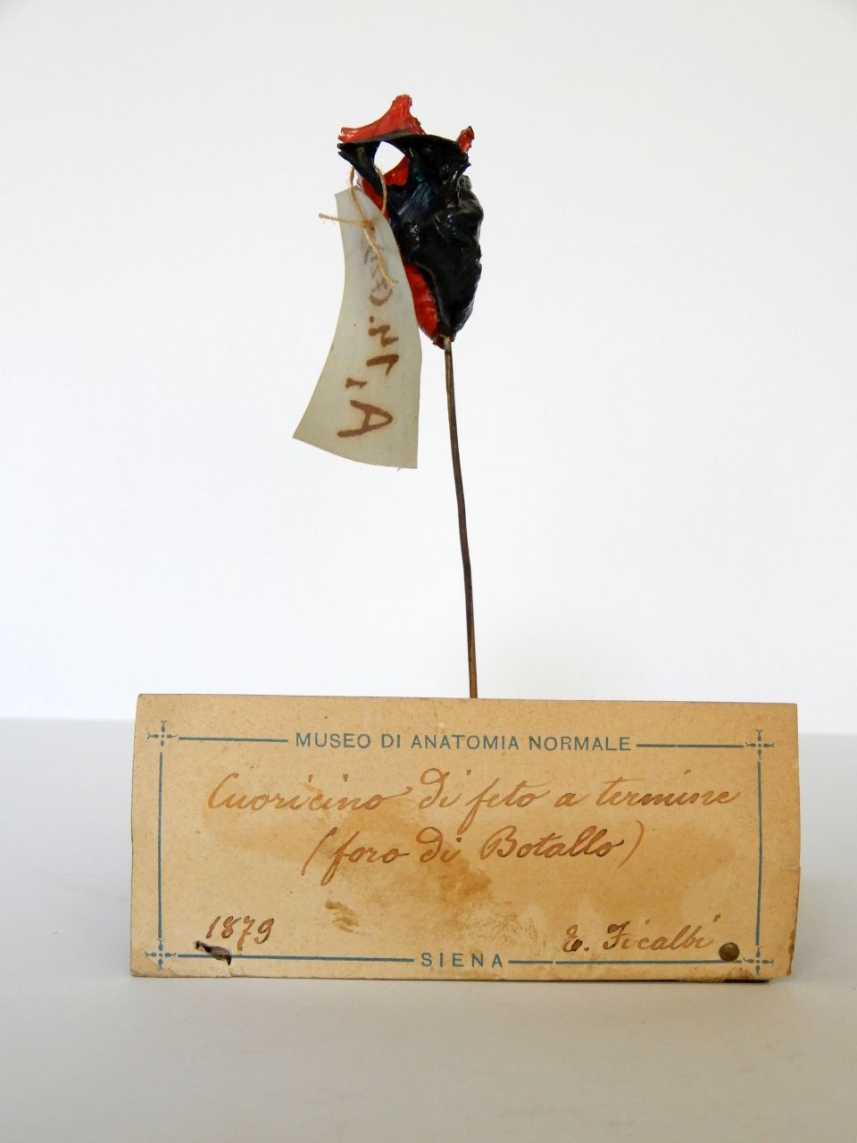 singolo reperto antropologico, preparato anatomico (apparato circolatorio), cuore di feto (morfologia/ struttura alterata post mortem per intervento antropico, trattato e colorato) (XIX)