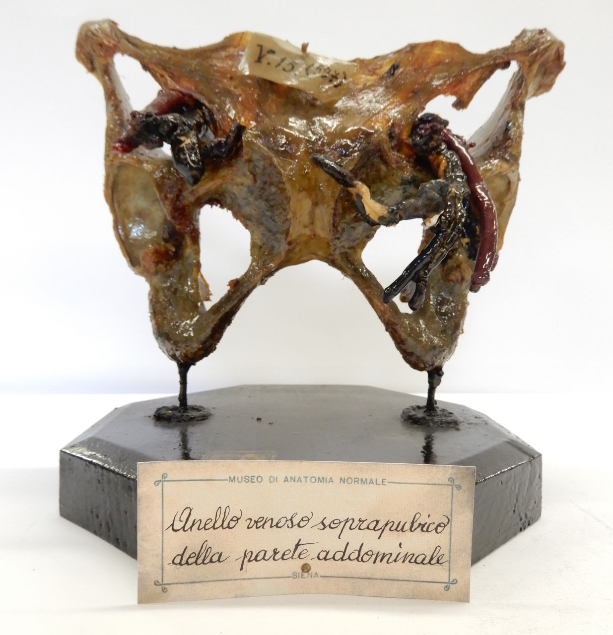 singolo reperto antropologico, preparato anatomico (apparato circolatorio), cavità pelvica (morfologia/ struttura alterata post mortem per intervento antropico, trattato e colorato) (XIX)