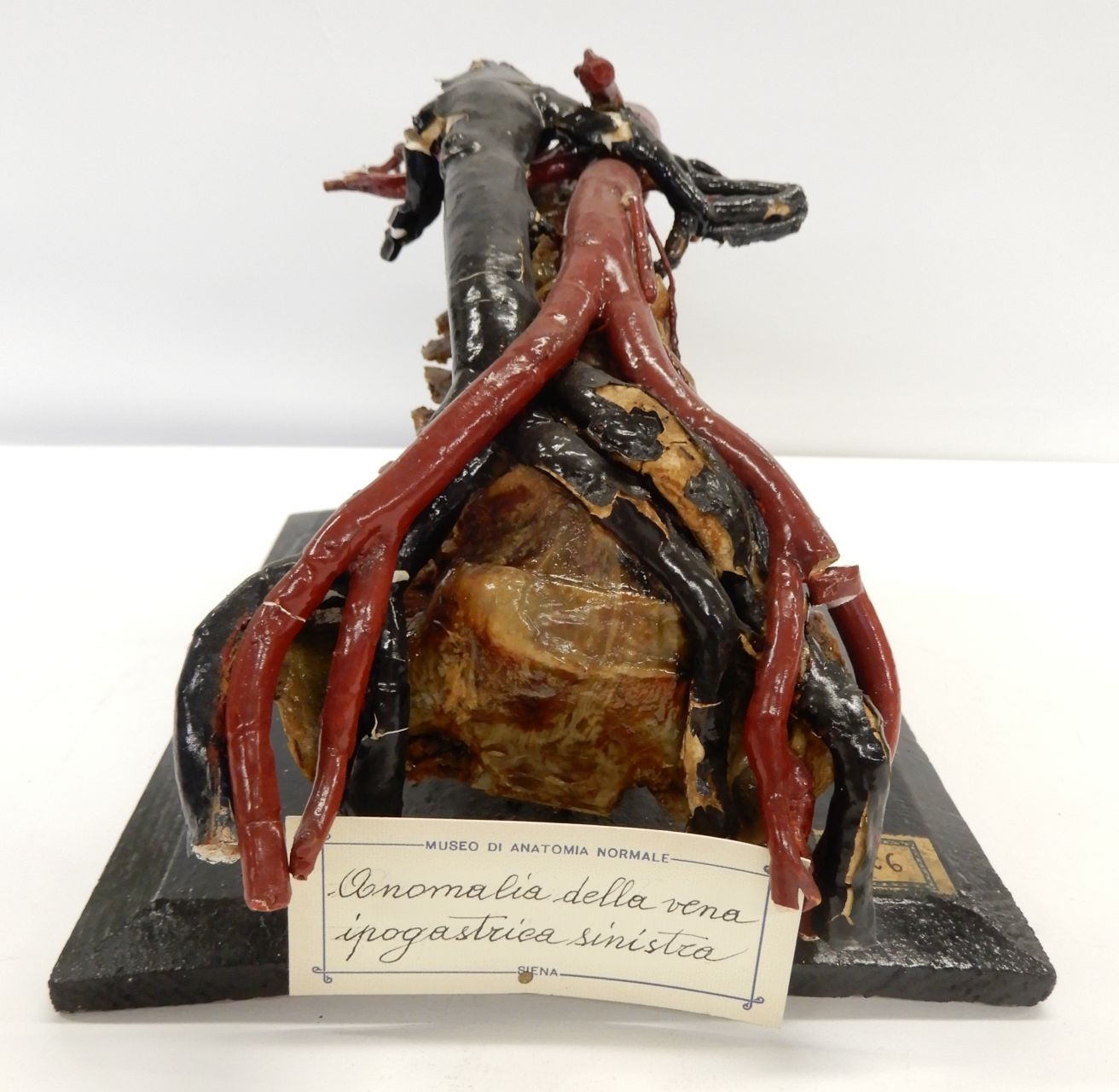 singolo reperto antropologico, preparato anatomico (apparato circolatorio), vene (morfologia/ struttura alterata post mortem per intervento antropico, trattato e colorato) (ultimo quarto XIX)