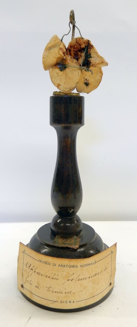 singolo reperto antropologico, preparato anatomico (apparato respiratorio), polmoni (morfologia/ struttura alterata post mortem per intervento antropico, trattato e colorato) (XX)