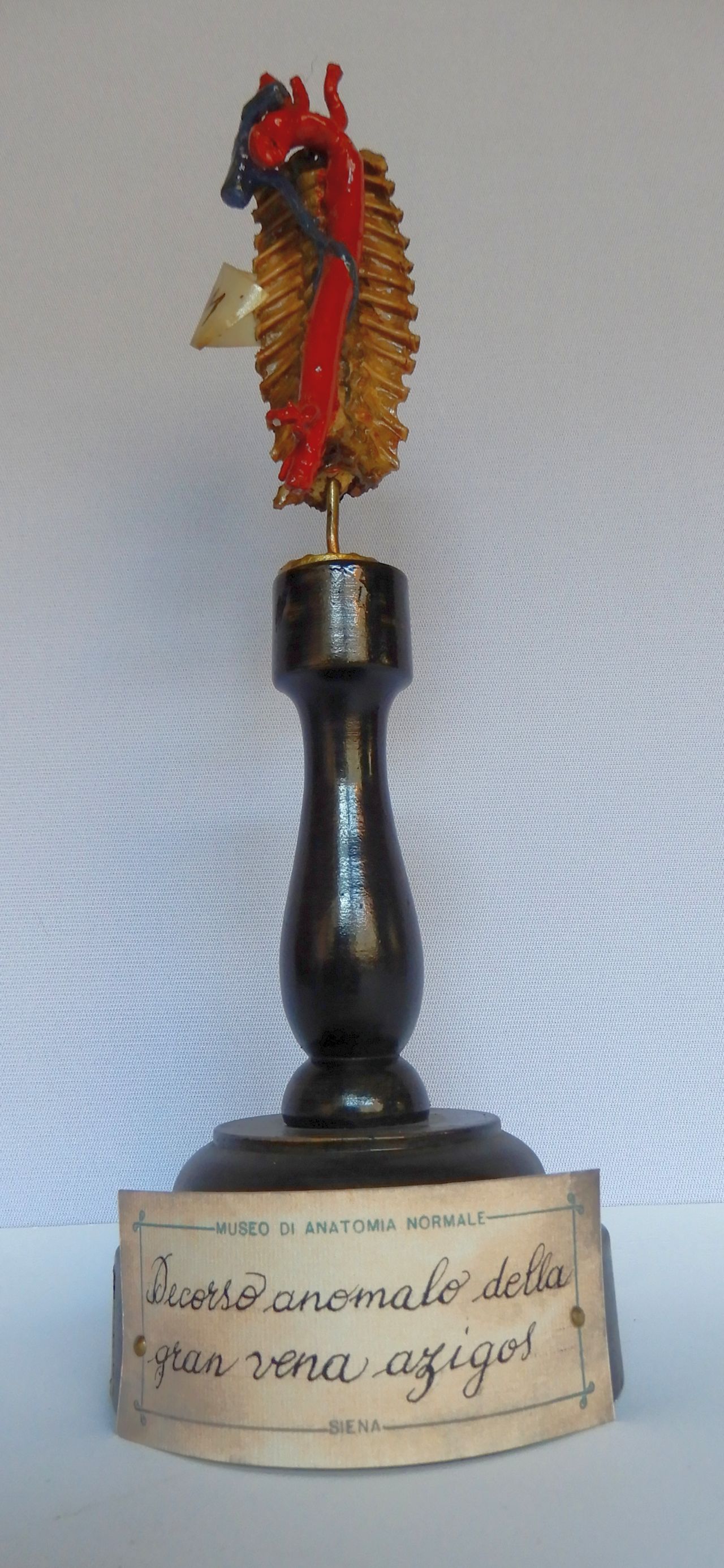 singolo reperto antropologico, preparato anatomico (apparato circolatorio) (morfologia/ struttura alterata post mortem per intervento antropico, trattato e colorato) (XIX)