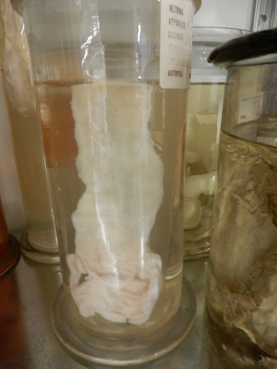 singolo reperto antropologico, preparato anatomico (morfologia alterata per patologia) (XIX-XX)