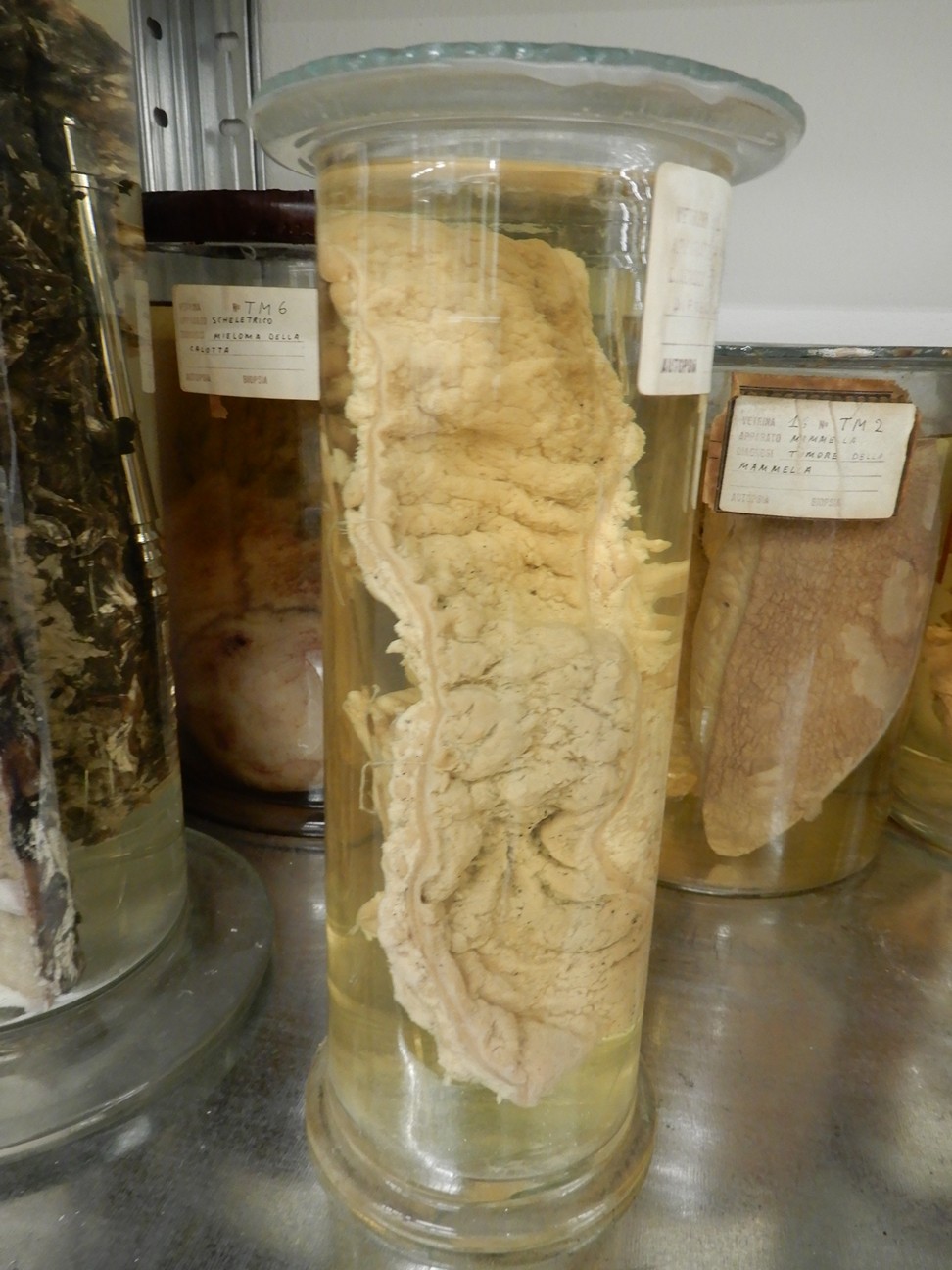 singolo reperto antropologico, preparato anatomico (morfologia alterata per patologia) (XIX-XX)