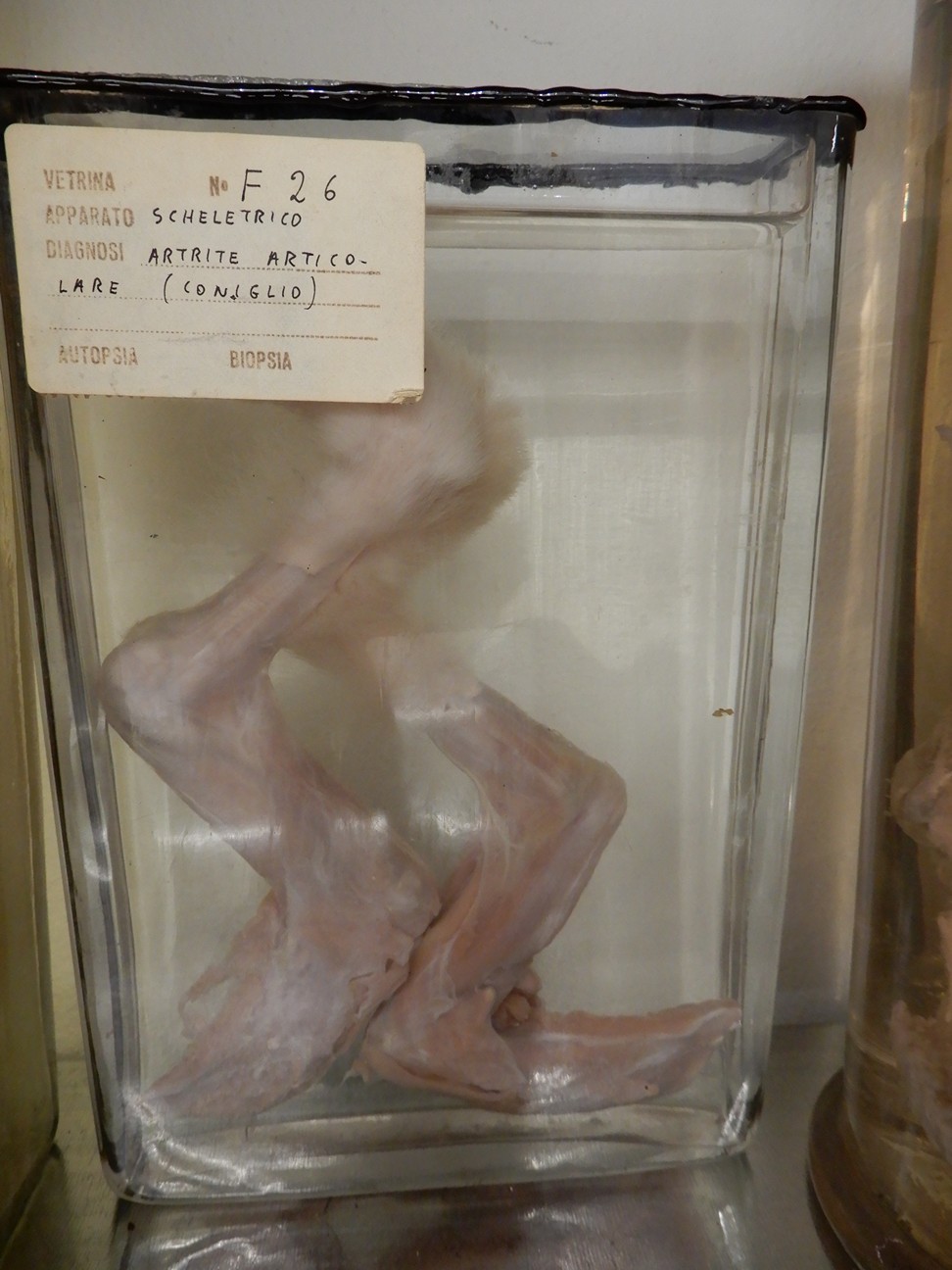 singolo reperto antropologico, preparato anatomico (morfologia alterata per patologia) (XIX-XX)