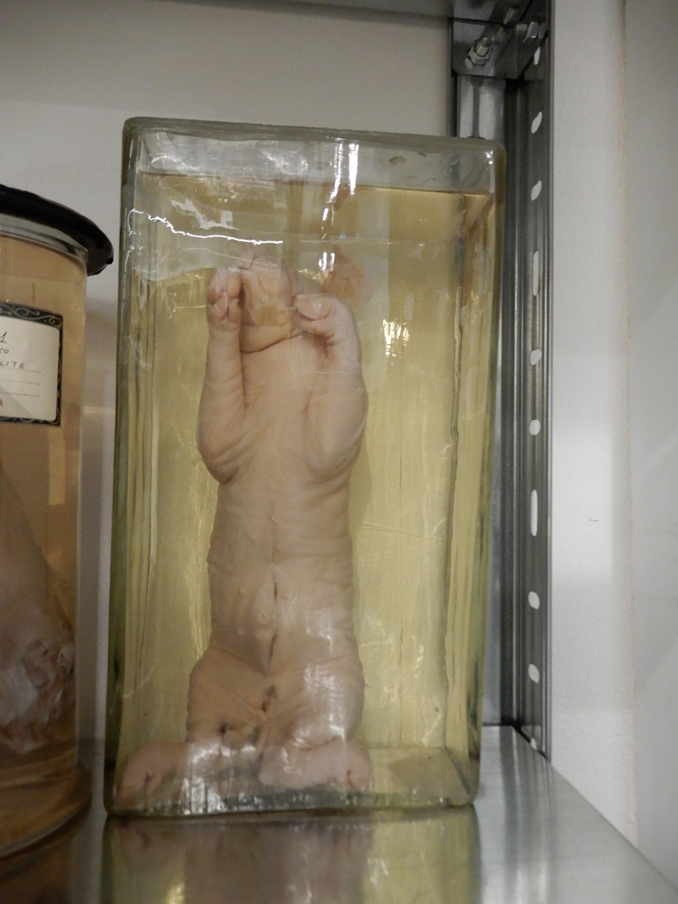 singolo reperto antropologico, preparato anatomico (morfologia alterata per patologia) (XIX-XX)