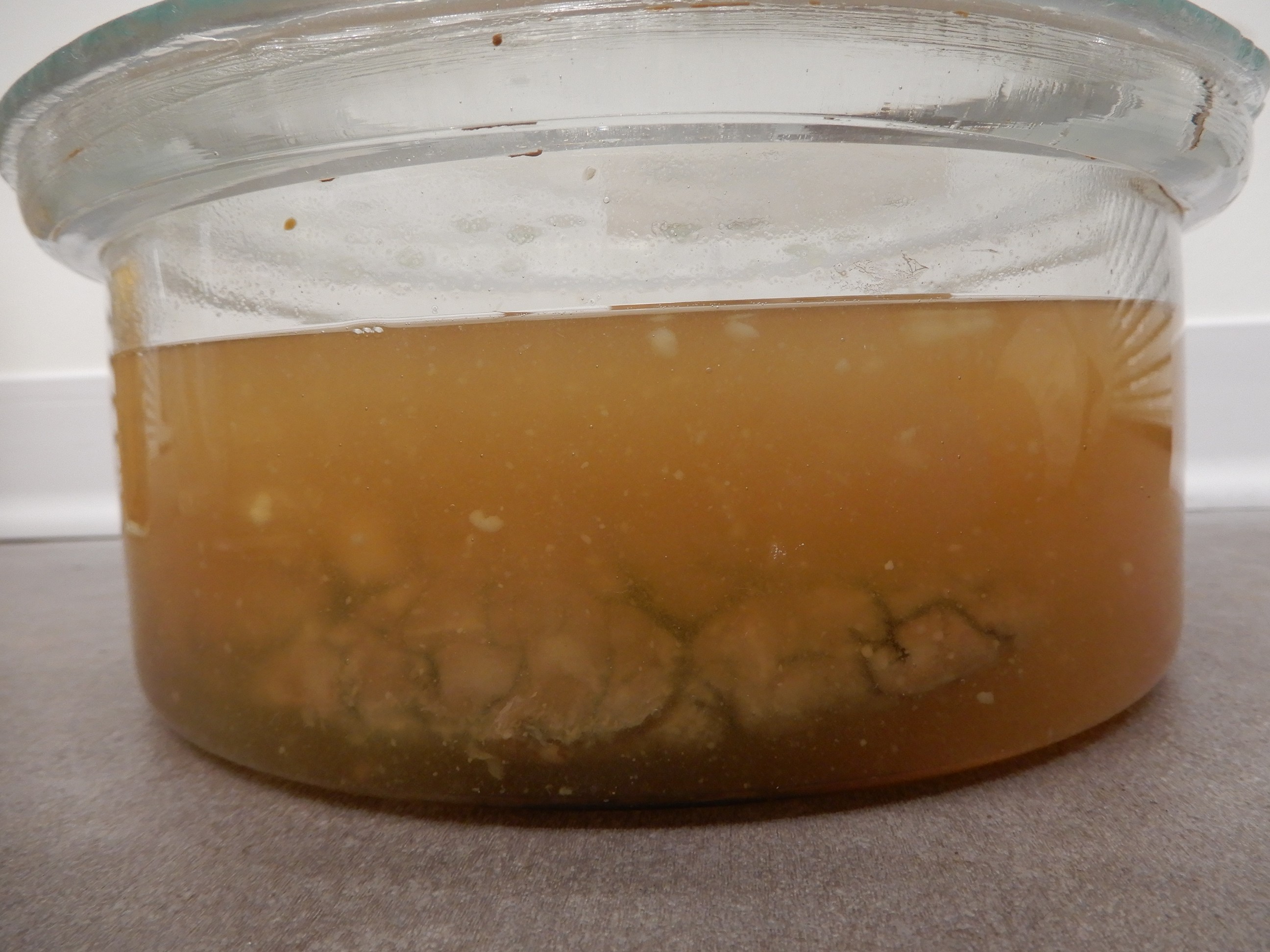 singolo reperto antropologico, preparato anatomico (morfologia alterata per patologia) (XIX-XX)