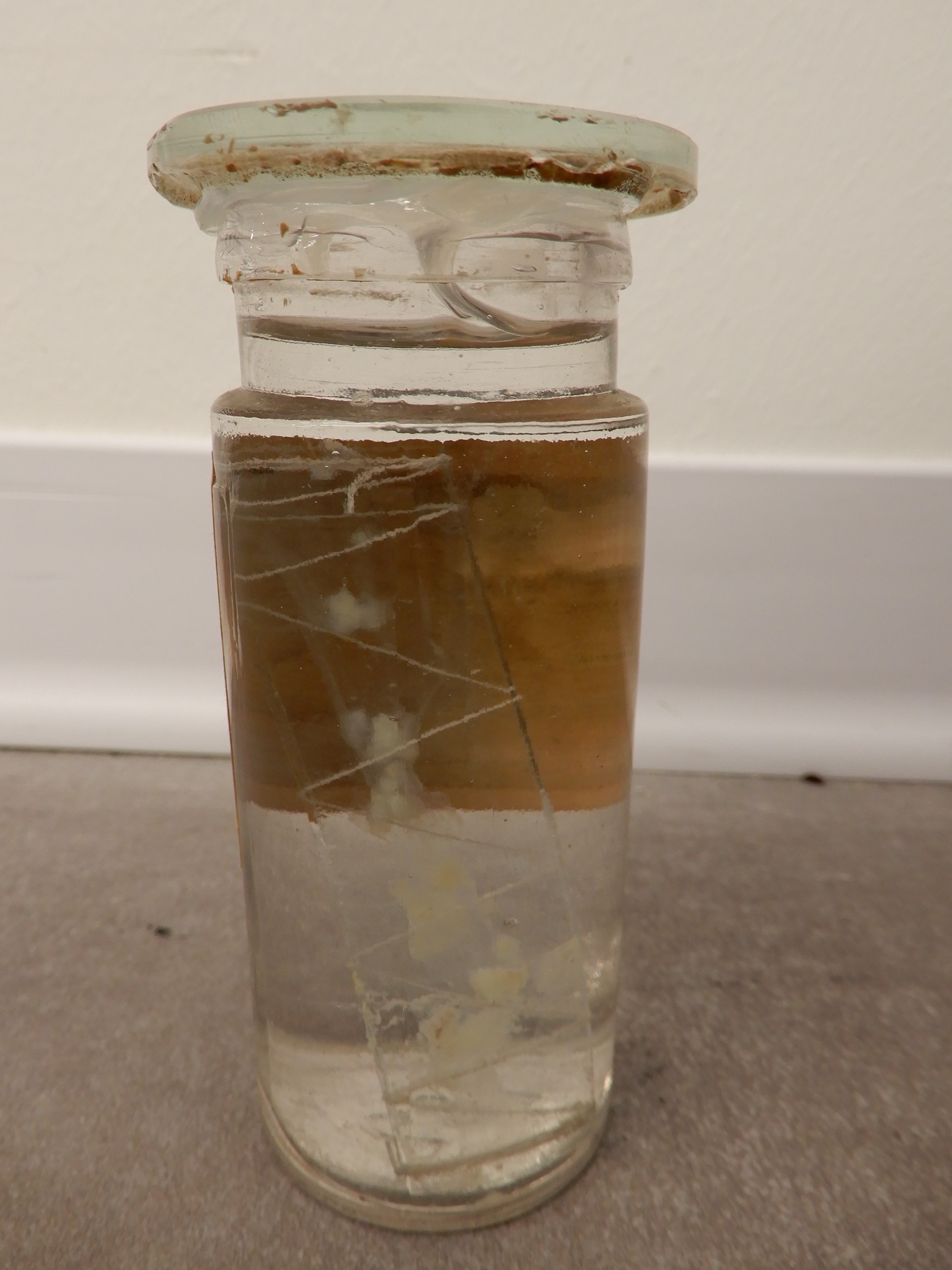 singolo reperto antropologico, preparato anatomico (morfologia alterata per patologia) (XIX-XX)