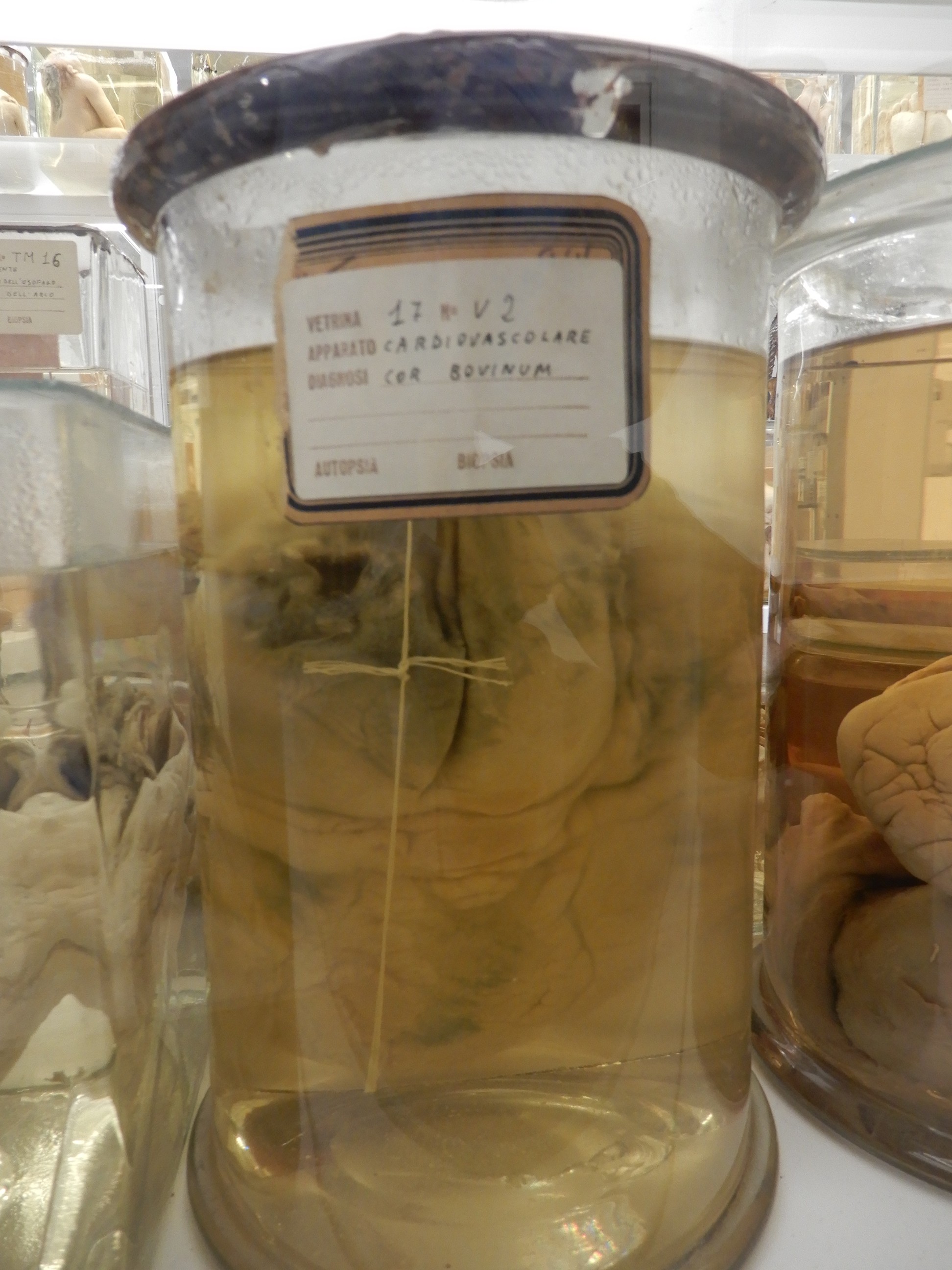 singolo reperto antropologico, preparato anatomico (morfologia alterata per patologia) (XIX-XX)