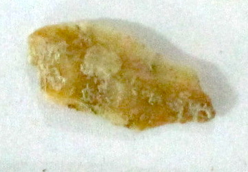 SINGOLO OGGETTO/ strumento, PERIODIZZAZIONI/ Storia/ Eta' antica/ Eta' romana/ Eta' romana imperiale