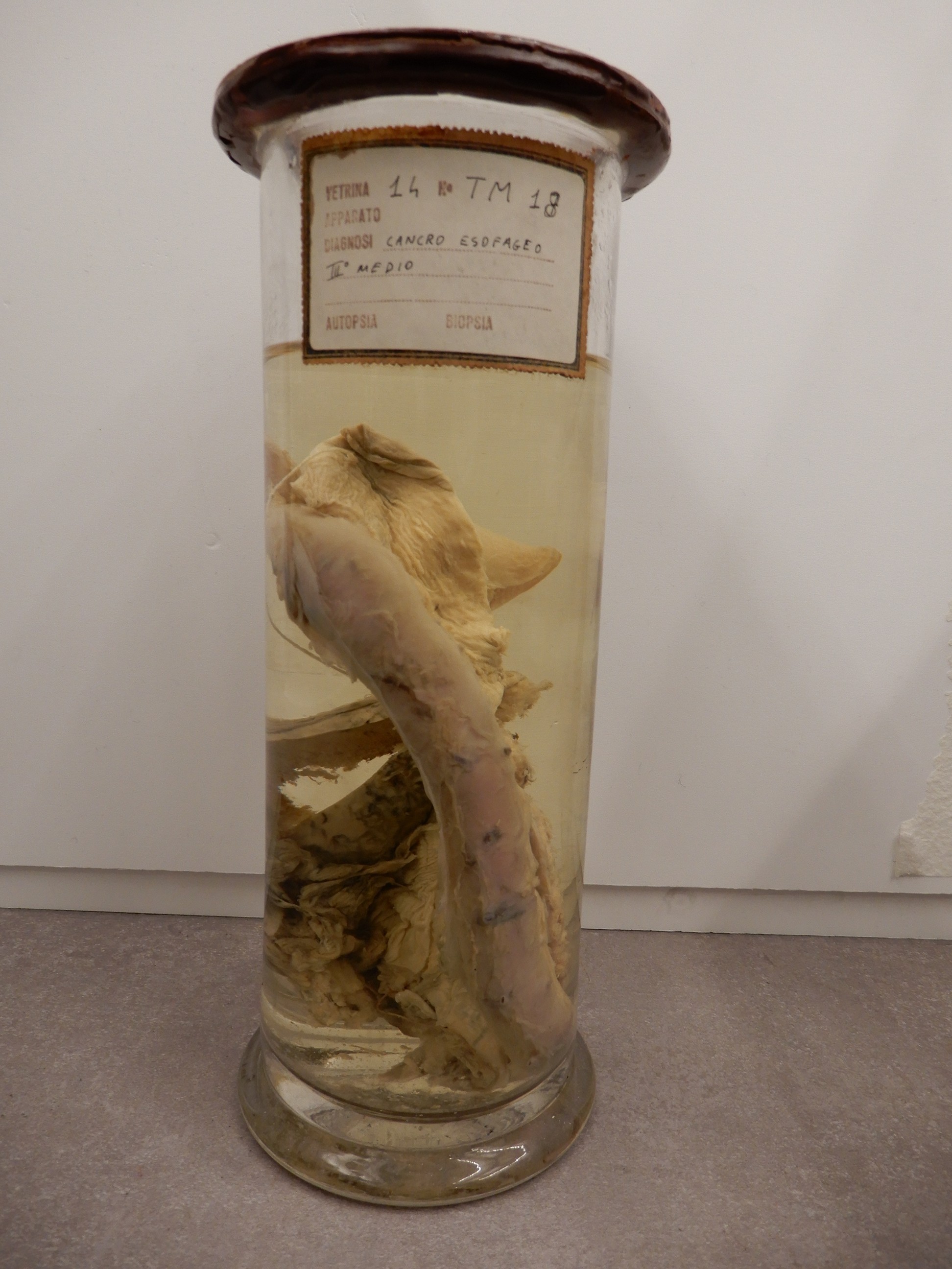 singolo reperto antropologico, preparato anatomico (morfologia alterata per patologia) (XIX-XX)