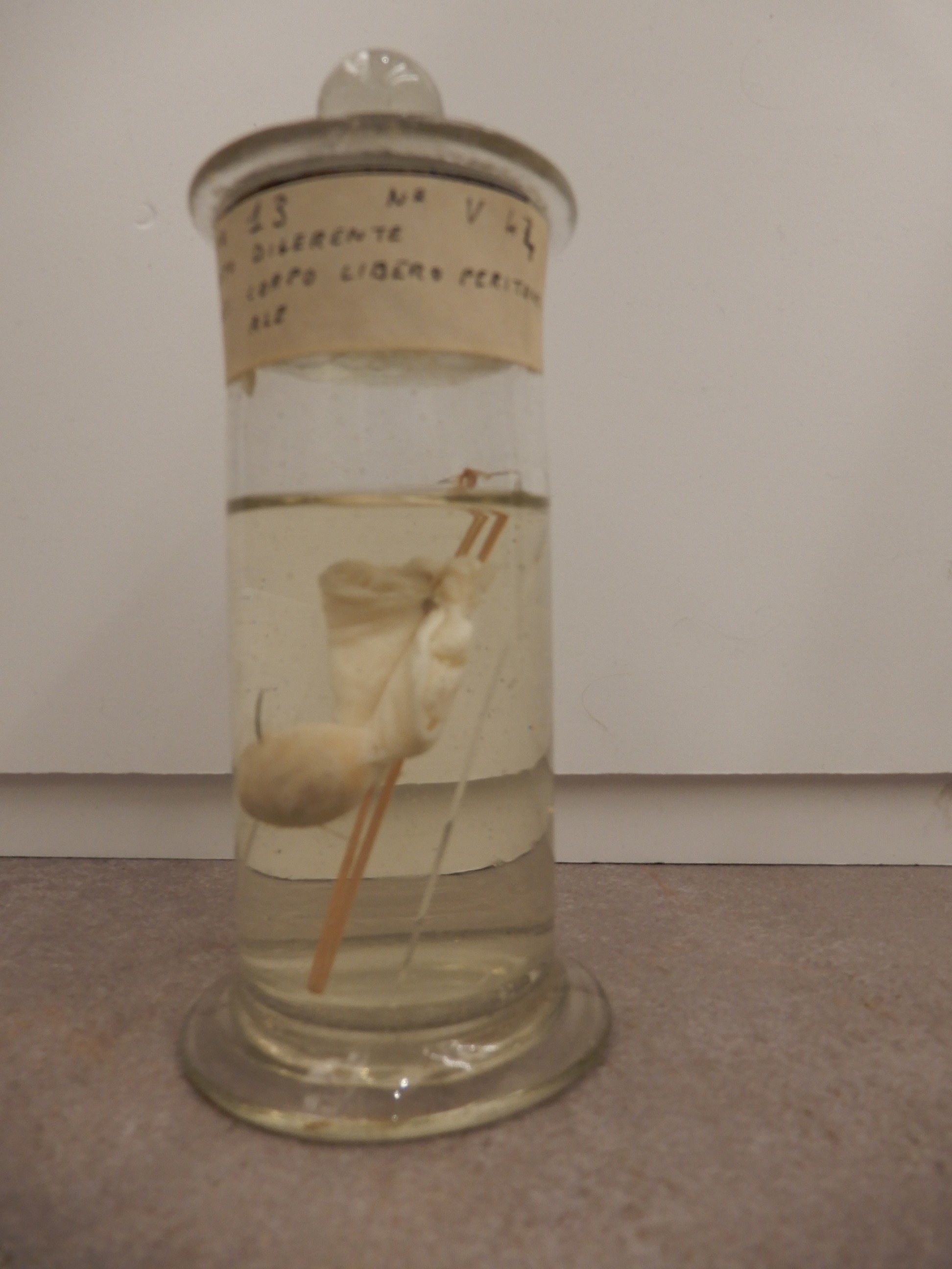 singolo reperto antropologico, preparato anatomico (morfologia alterata per patologia) (XIX-XX)