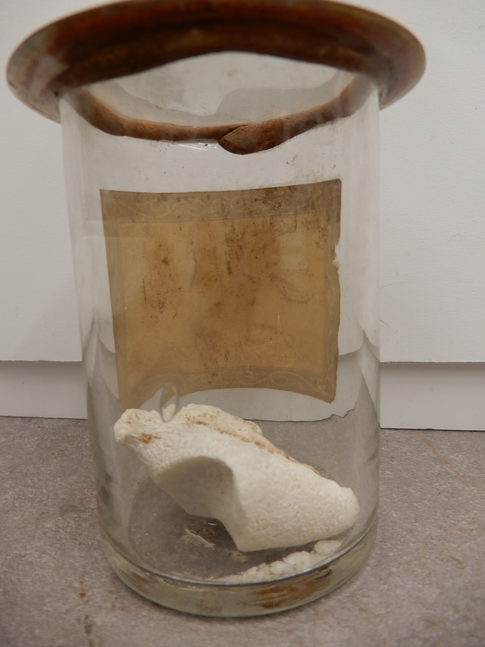 singolo reperto antropologico, preparato anatomico (morfologia alterata per patologia) (XIX-XX)