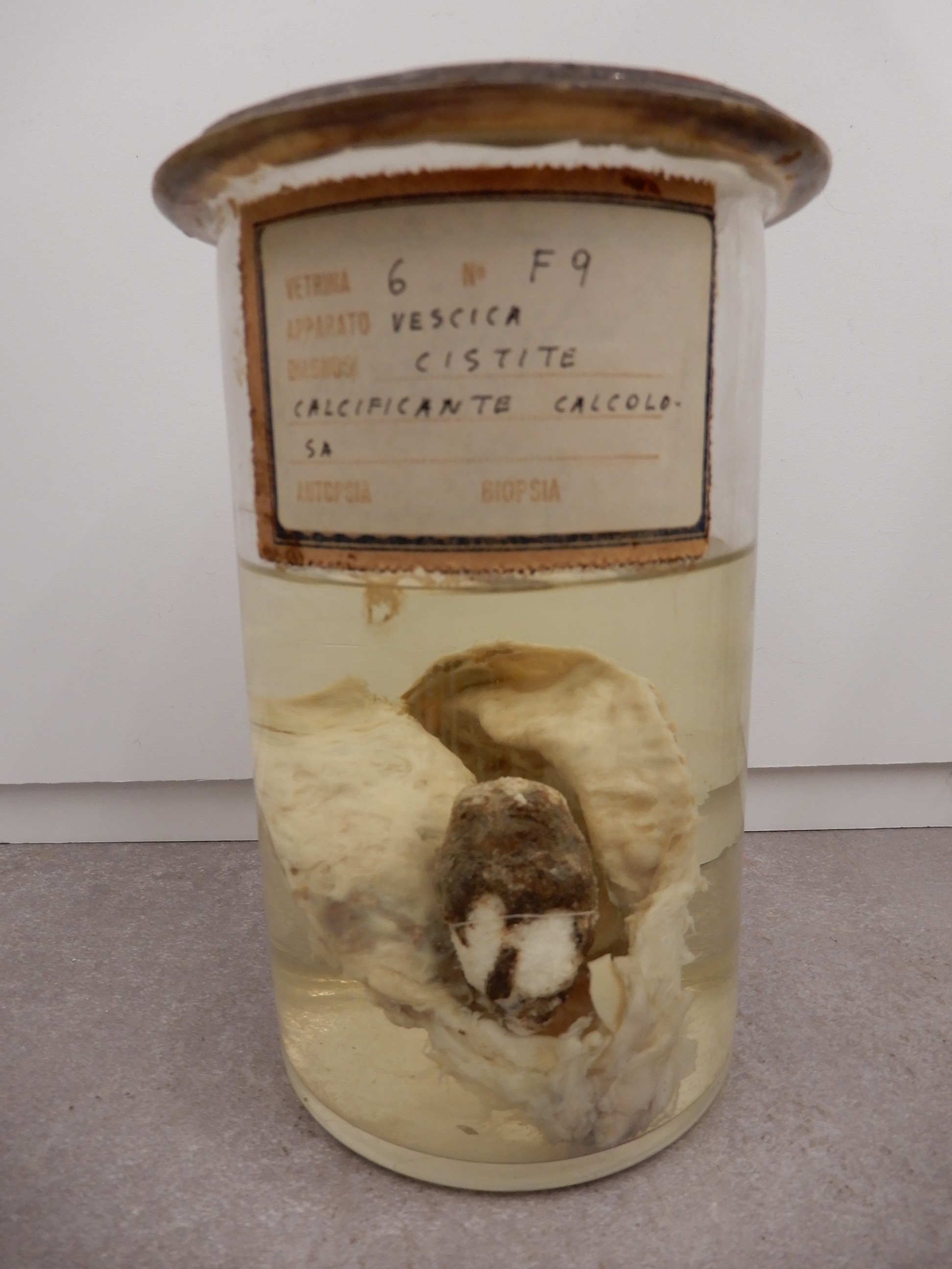 singolo reperto antropologico, preparato anatomico (morfologia alterata per patologia) (XIX-XX)