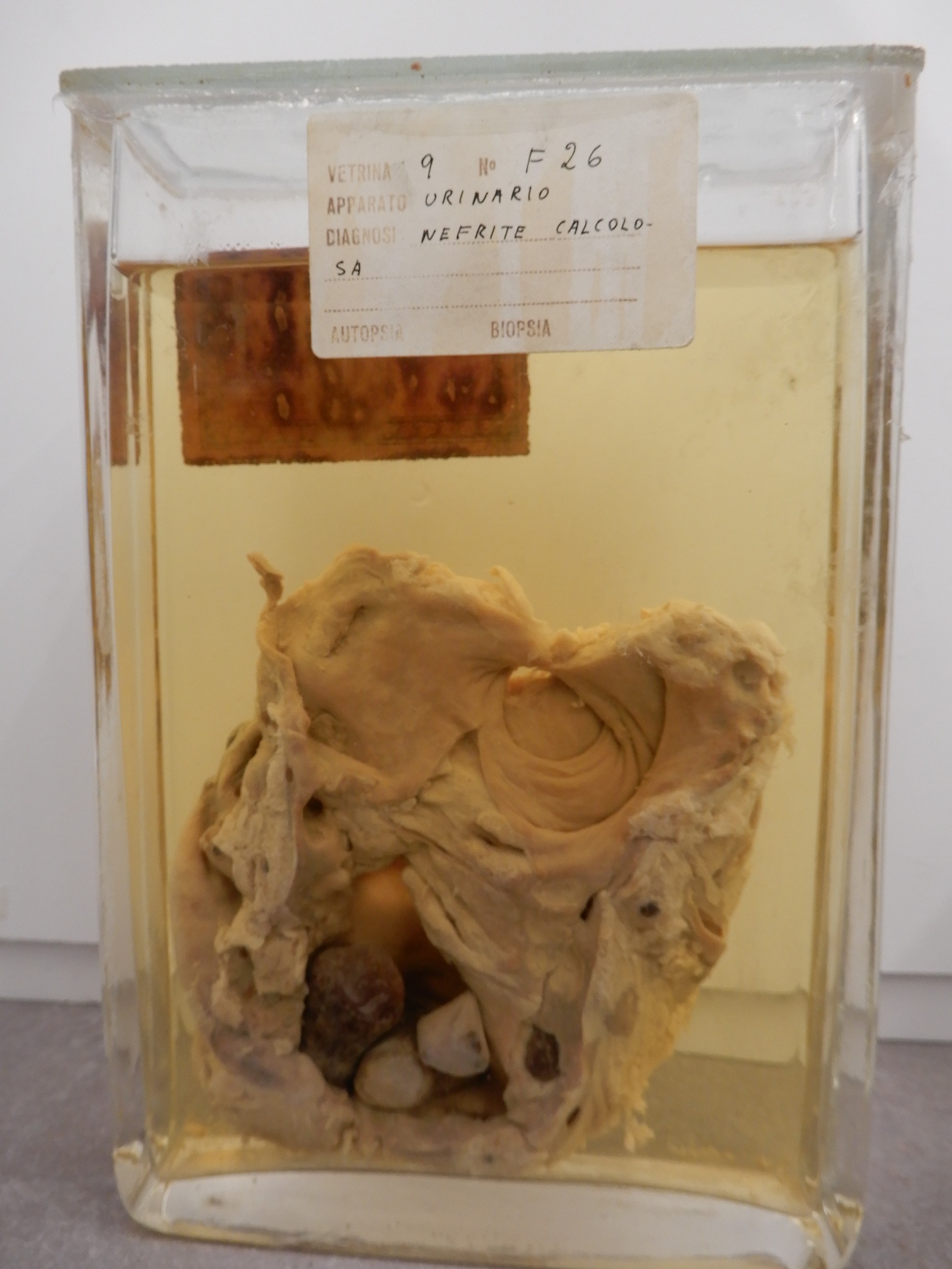 singolo reperto antropologico, preparato anatomico (morfologia alterata per patologia) (XIX-XX)