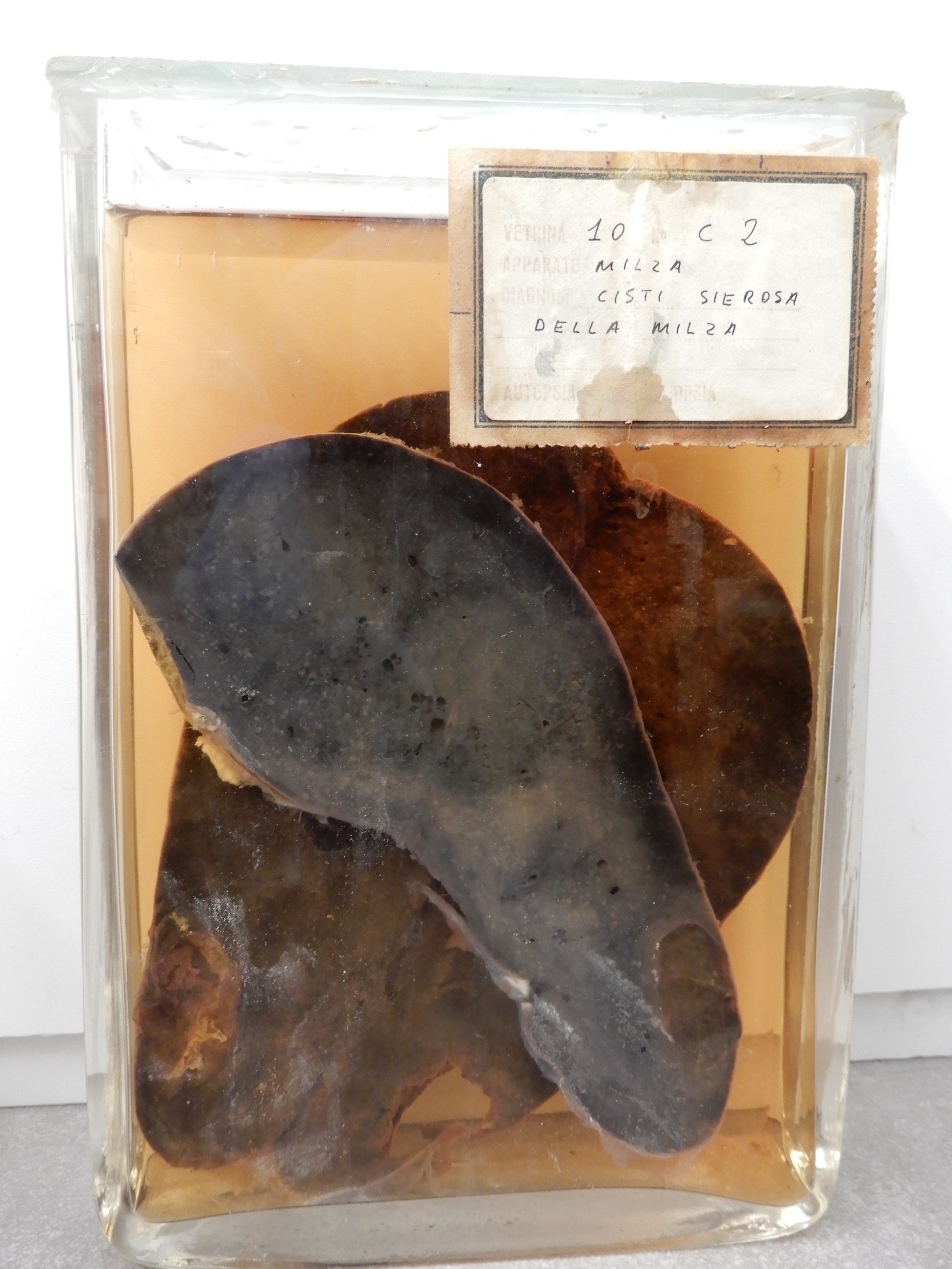 singolo reperto antropologico, preparato anatomico (morfologia alterata per patologia) (XIX-XX)