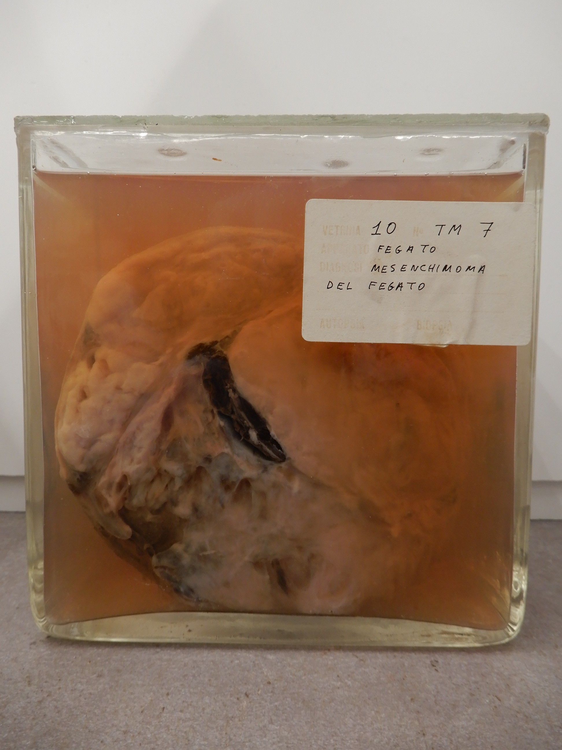 singolo reperto antropologico, preparato anatomico (morfologia alterata per patologia) (XIX-XX)