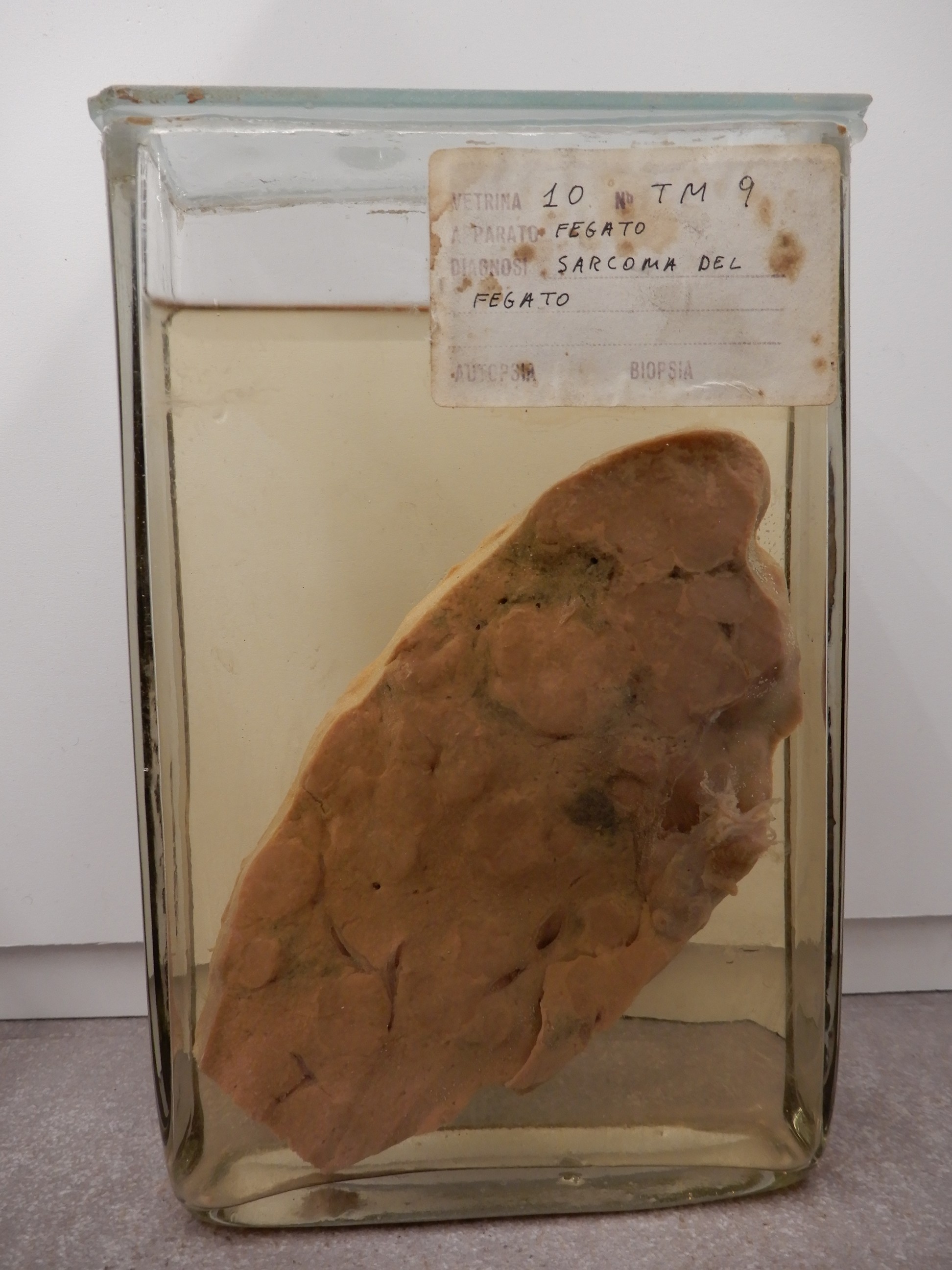 singolo reperto antropologico, preparato anatomico (morfologia alterata per patologia) (XIX-XX)