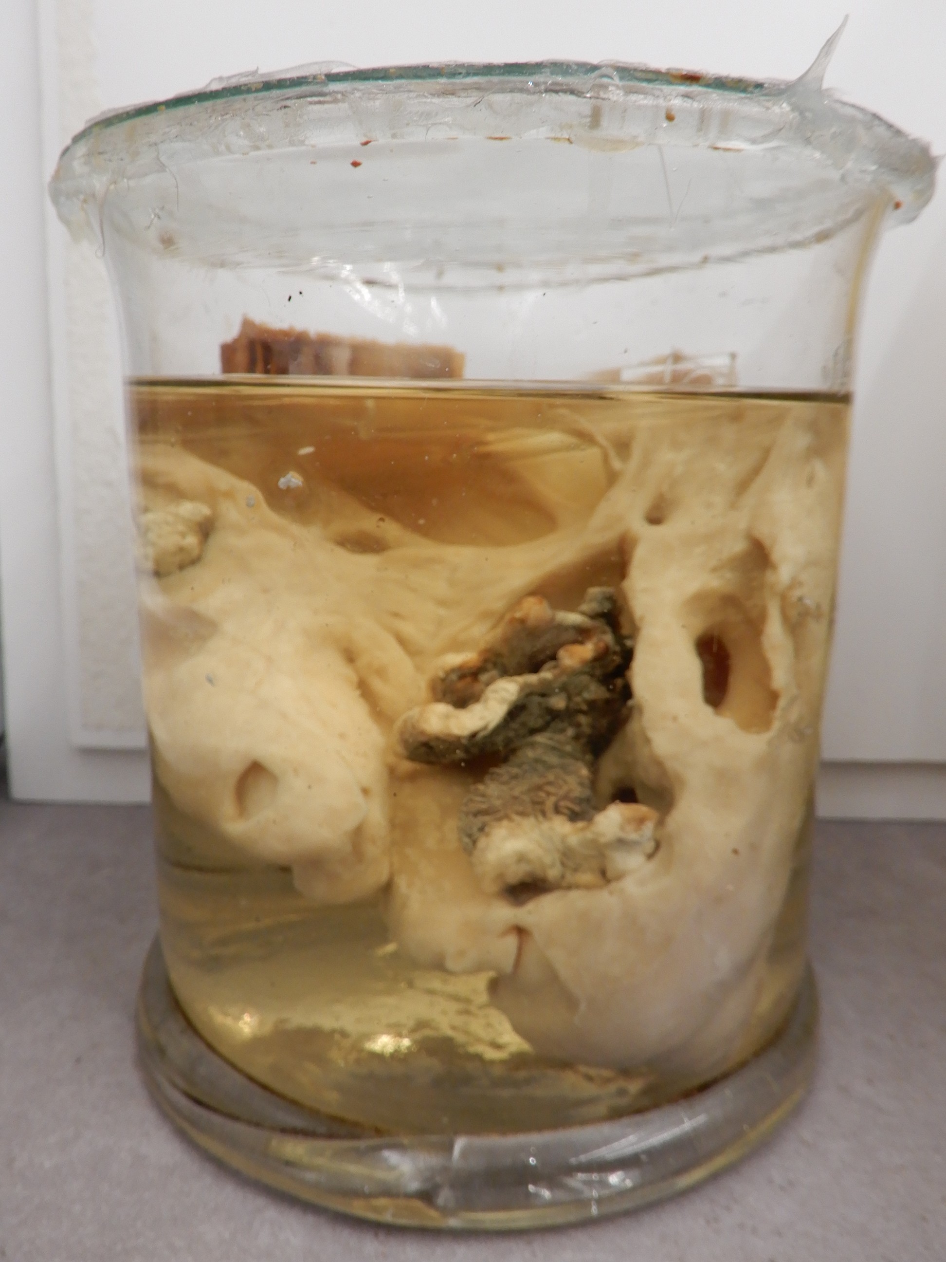 singolo reperto antropologico, preparato anatomico (morfologia alterata per patologia) (XIX-XX)