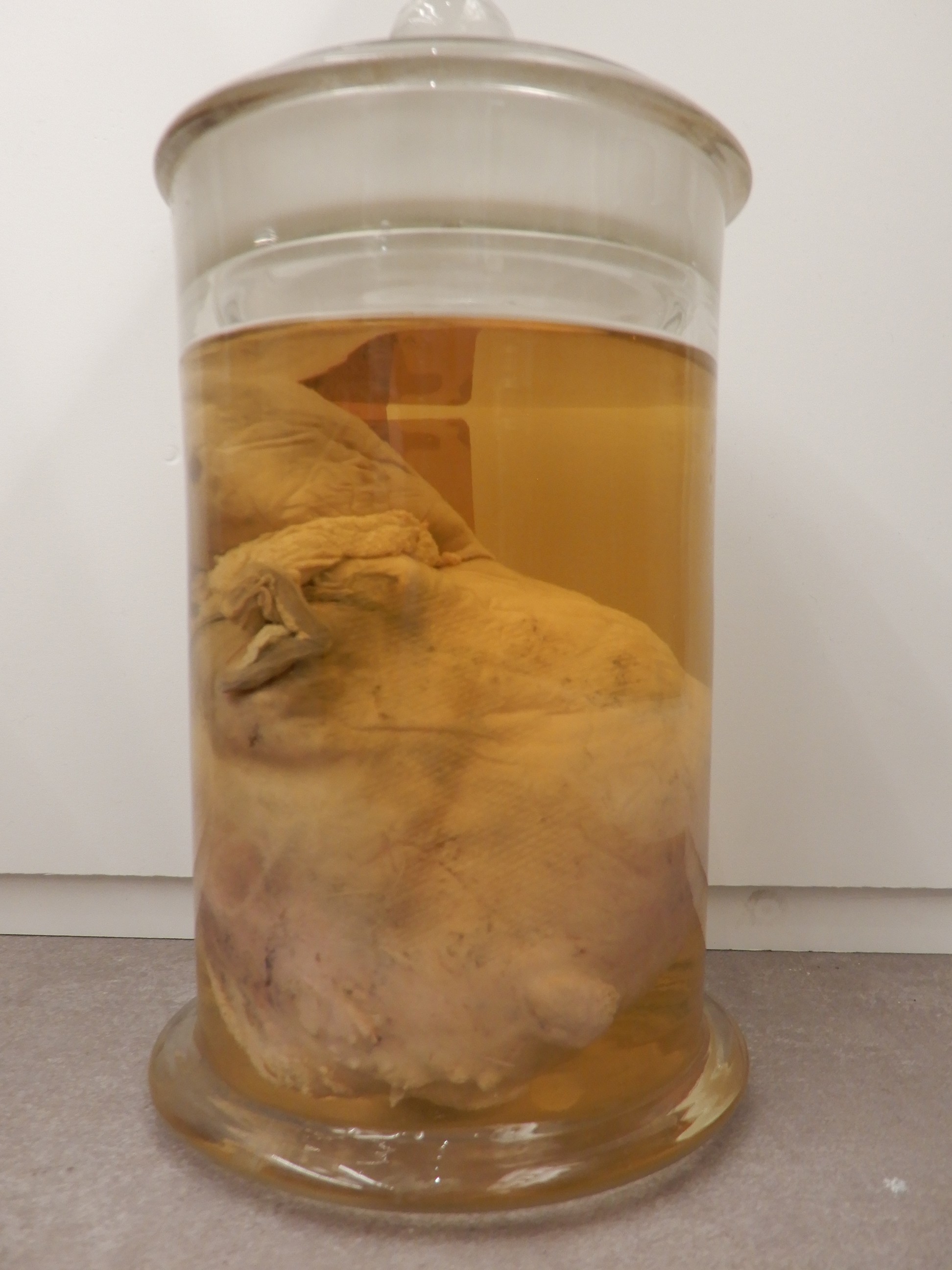 singolo reperto antropologico, preparato anatomico (morfologia alterata per patologia) (XIX-XX)