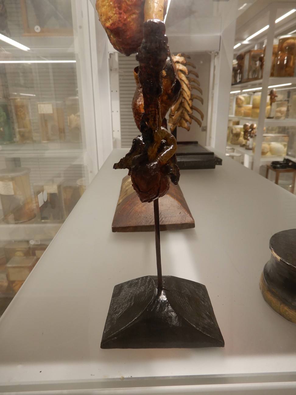 singolo reperto antropologico, preparato anatomico (morfologia alterata per patologia) (XIX-XX)