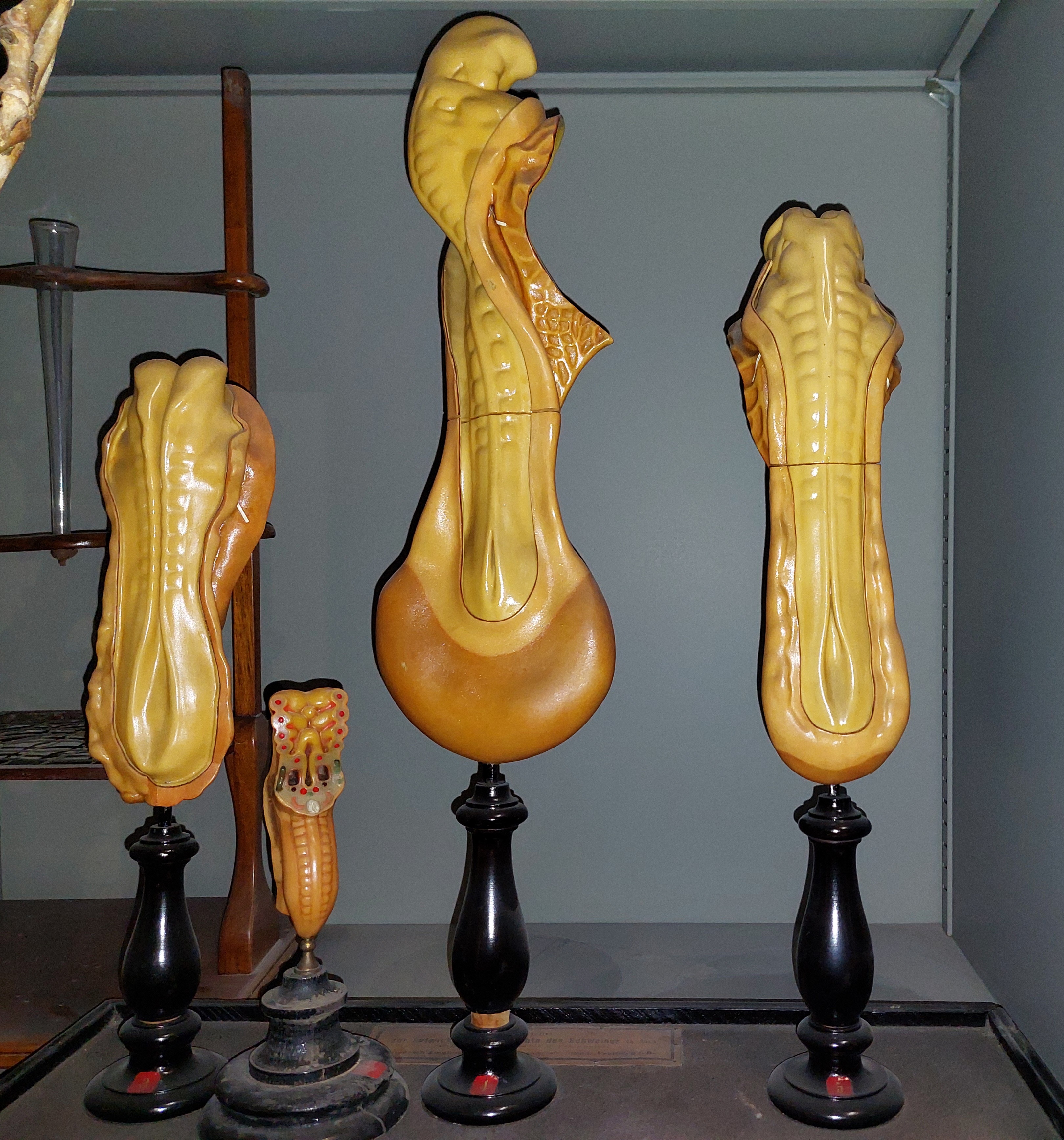 cera anatomica di Ziegler, Friedrich (bottega) (metà/ inizio XIX secolo)