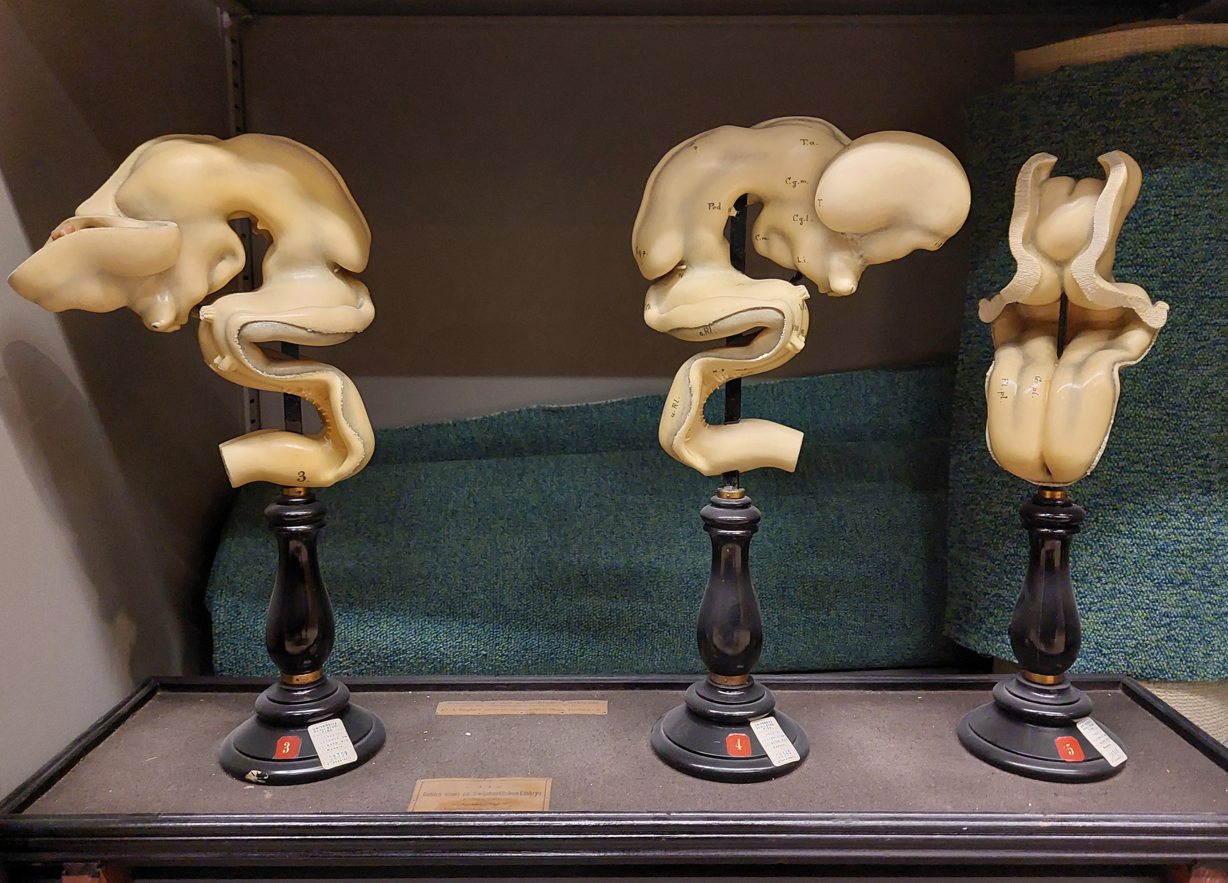 cera anatomica di Ziegler, Adolf (bottega) (seconda metà XIX)