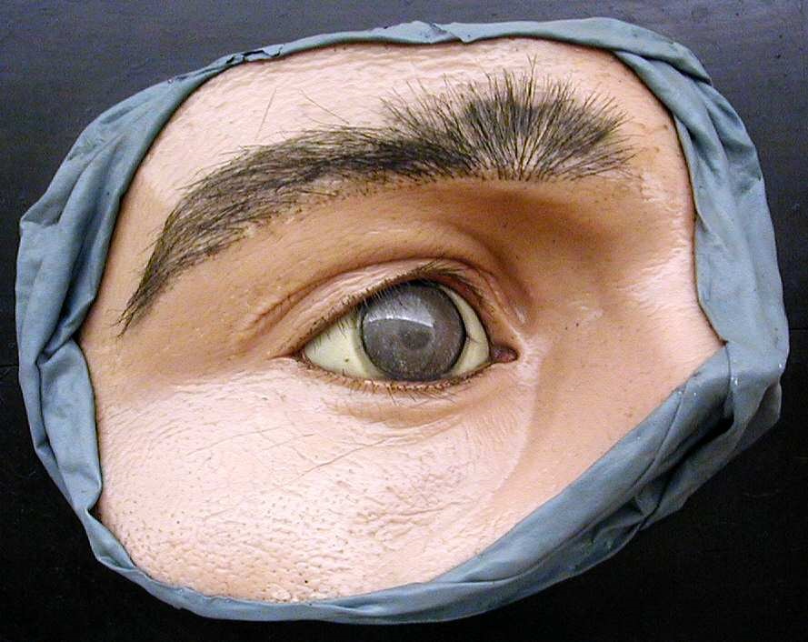 modello, modello anatomico di Bettini, Cesare (metà XIX sec)