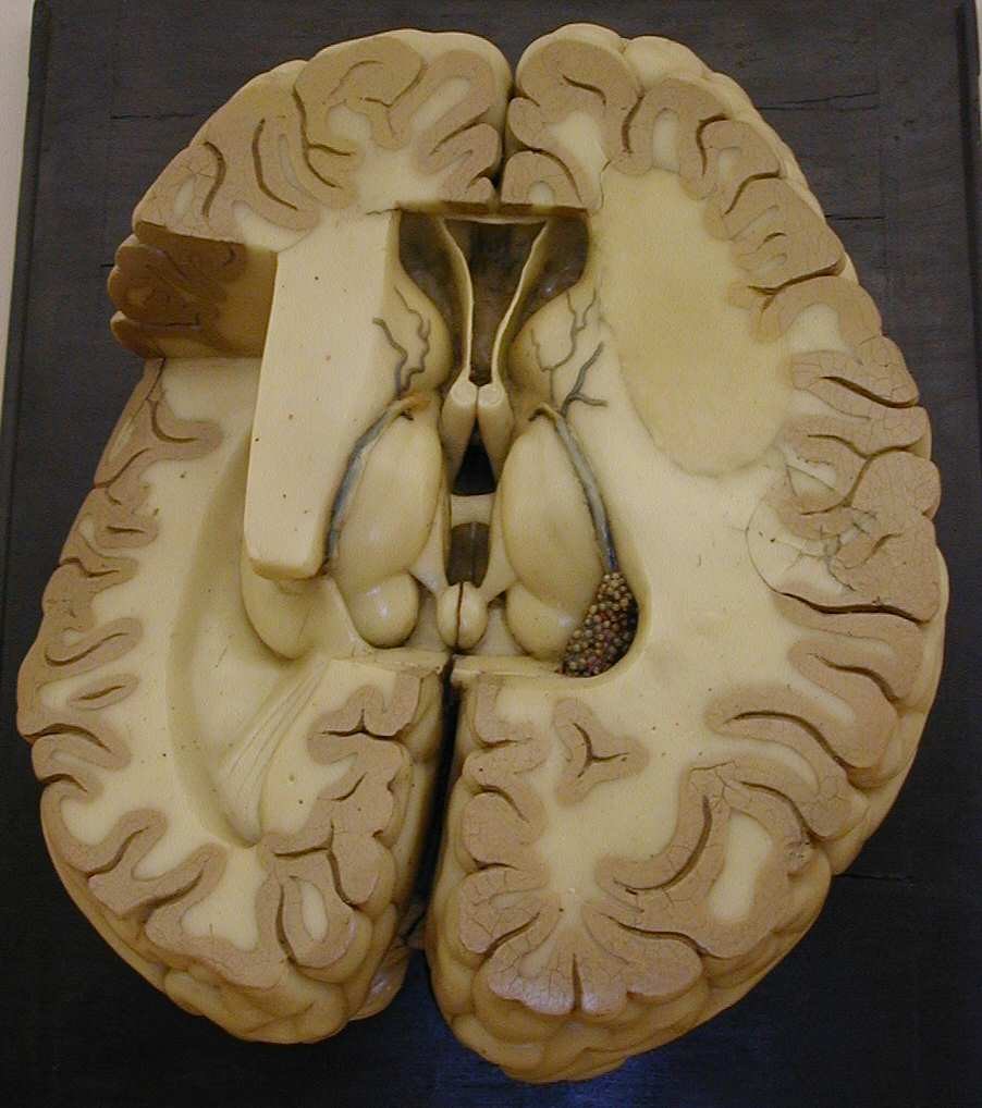 modello, modello anatomico di Bettini, Cesare (metà XIX sec)