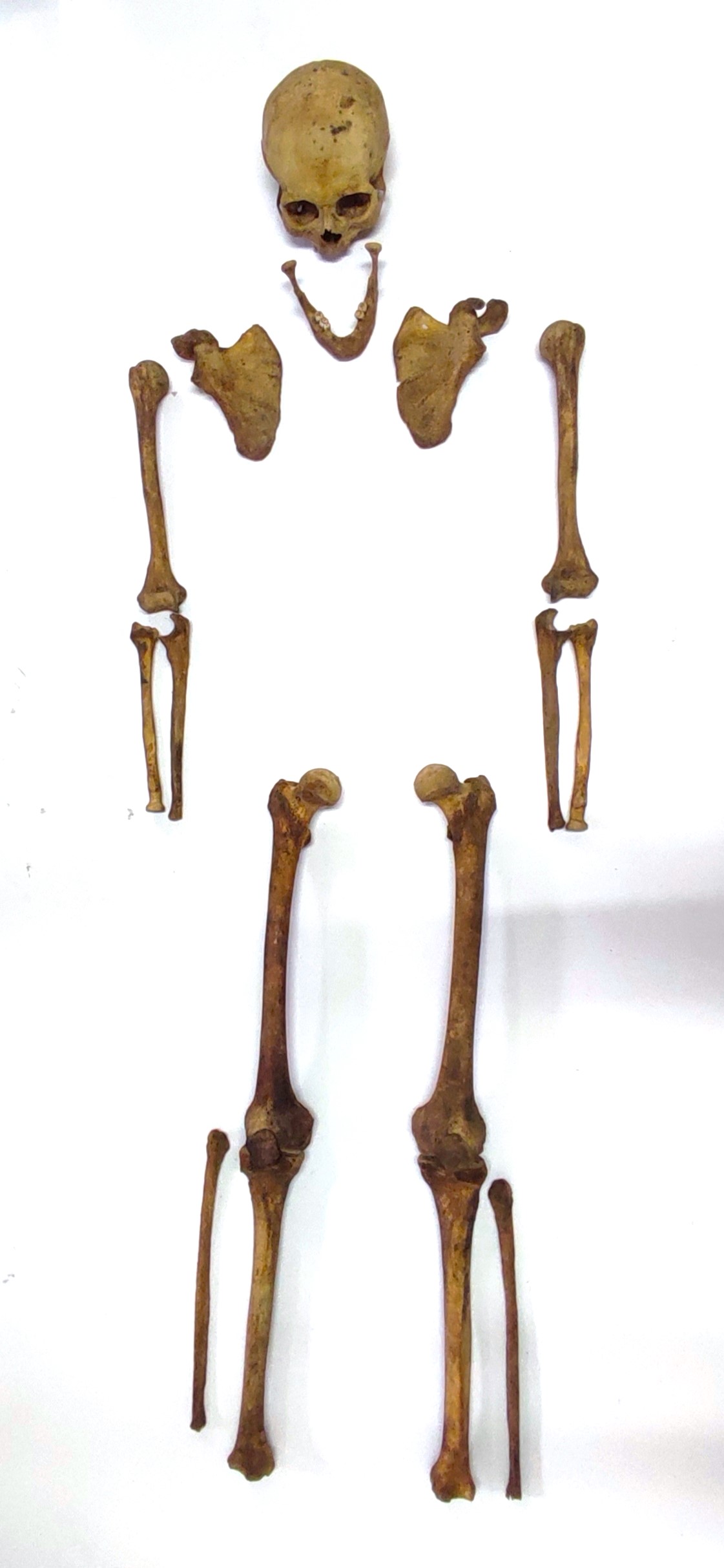 reperti antropologici pertinenti a un unico individuo, reperti ossei (non determinabile)