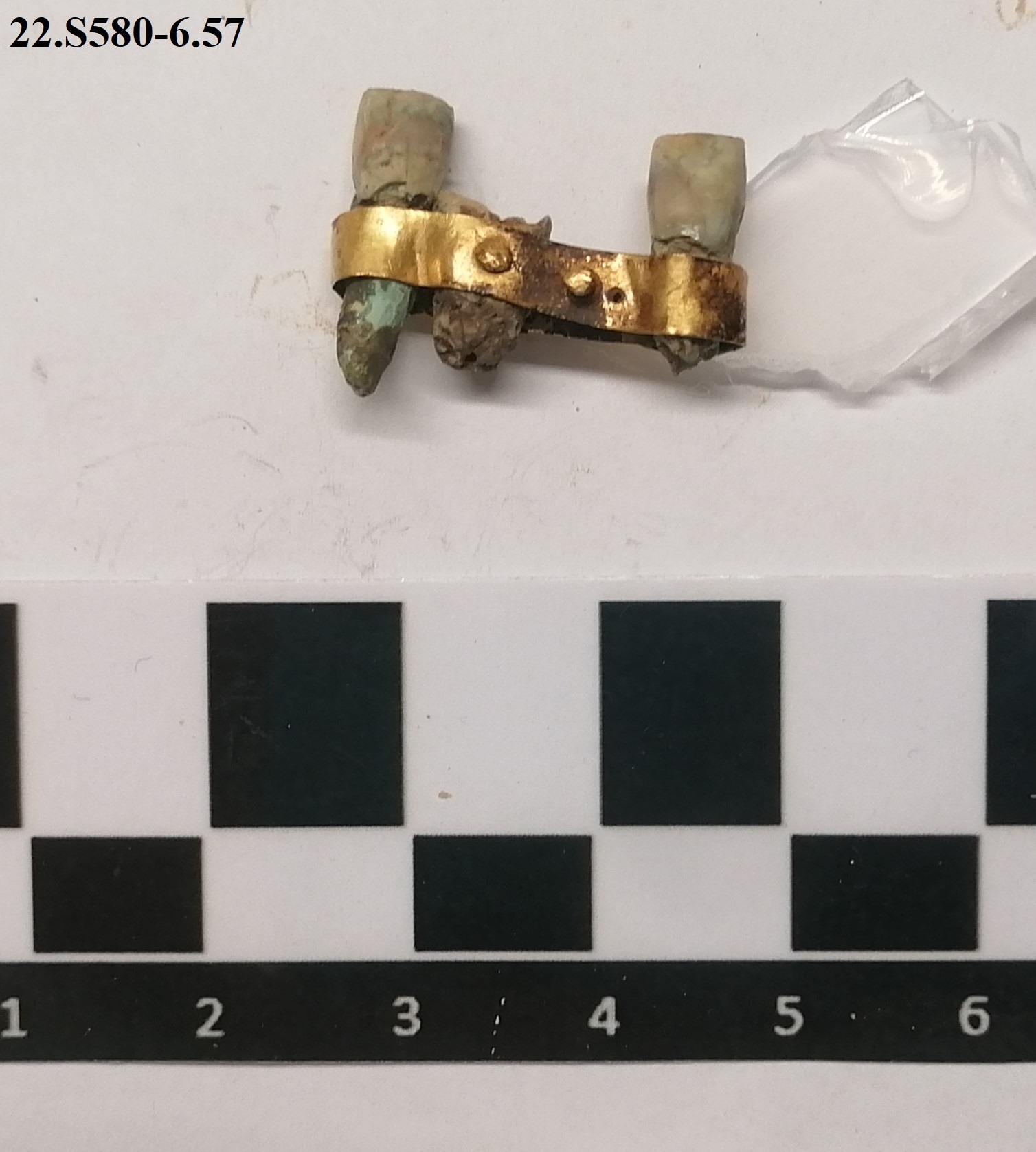 SINGOLO OGGETTO/ impianto dentale, PERIODIZZAZIONI/ ARCHI DI PERIODI/ VII - VI sec. a.C