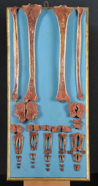 preparato anatomico, fibula, tibia e ossa del piede sezionati di Lelli Ercole (e aiuti) (sec. XVIII)