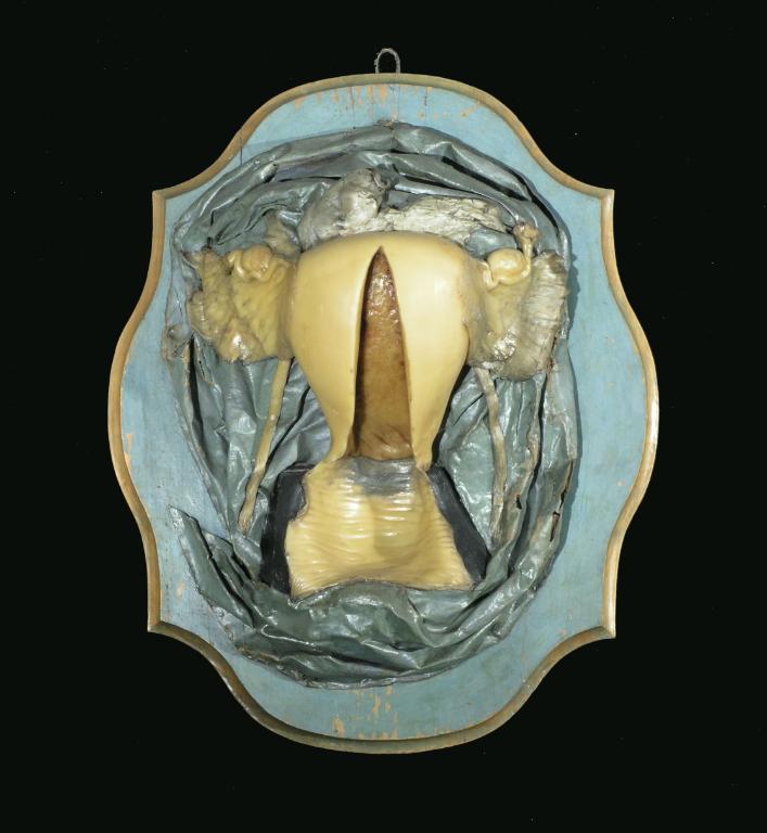 preparato anatomico, organo genitale femminile di Morandi Anna (sec. XVIII)