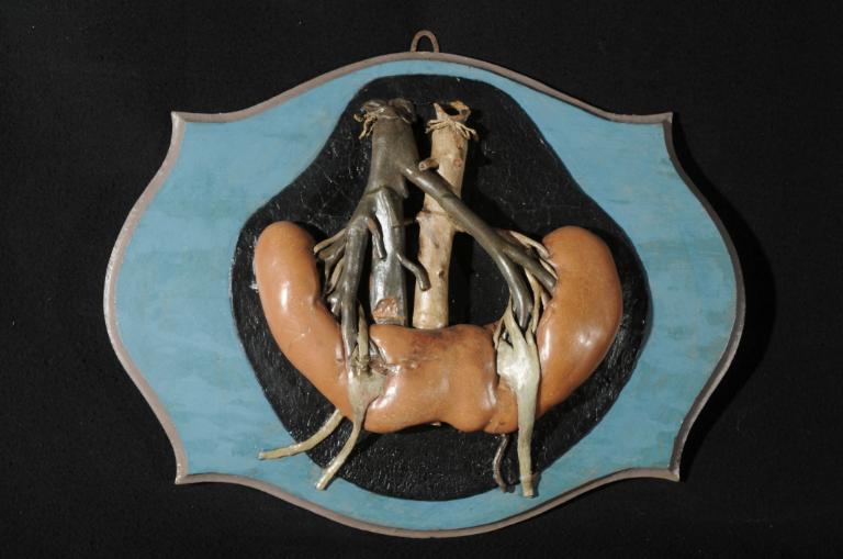 preparato anatomico, rene a ferro di cavallo di Manzolini Giovanni (sec. XVIII)
