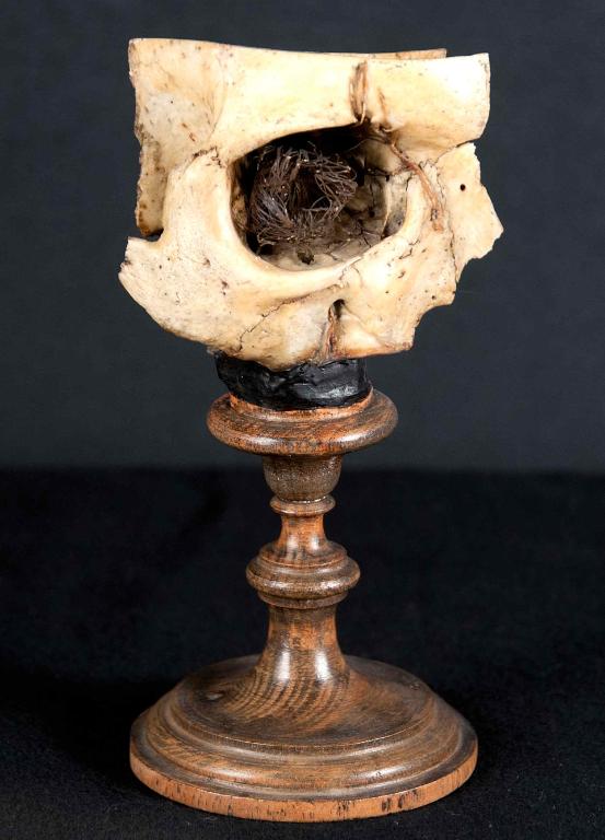 preparato anatomico, cavità orbitale di Morandi Anna (sec. XVIII)
