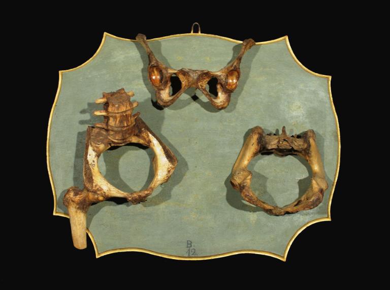 preparato ostetrico, osso pelvico femminile di Manzolini Giovanni, Morandi Anna (sec. XVIII)