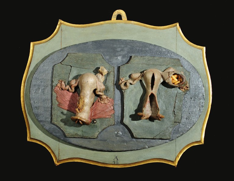 preparato ostetrico, apparato genitale femminile di Manzolini Giovanni, Morandi Anna (sec. XVIII)