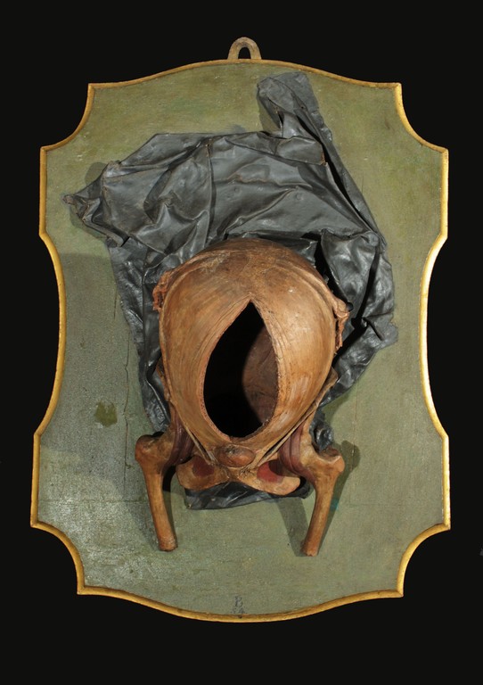 preparato ostetrico, apparato genitale femminile di Manzolini Giovanni, Morandi Anna (sec. XVIII)