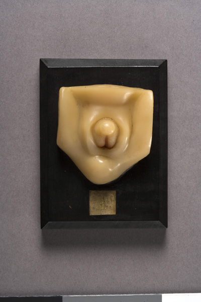 EMBRIONE DI ZIEGLER, sviluppo dell'embrione umano (modello anatomico, opera isolata) di Ziegler, Friedrich (laboratorio) (fine XIX)