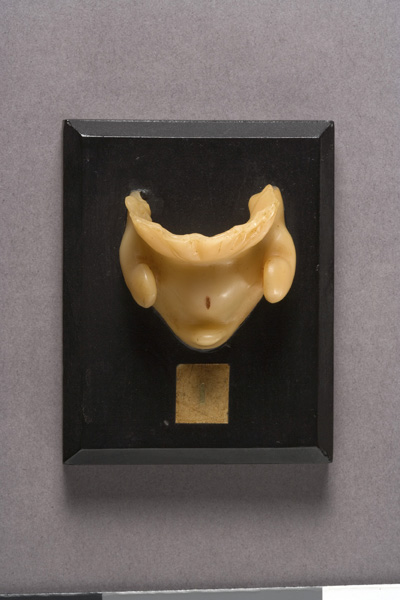 EMBRIONE DI ZIEGLER, sviluppo dell'embrione umano (modello anatomico, opera isolata) di Ziegler, Friedrich (laboratorio) (fine XIX)