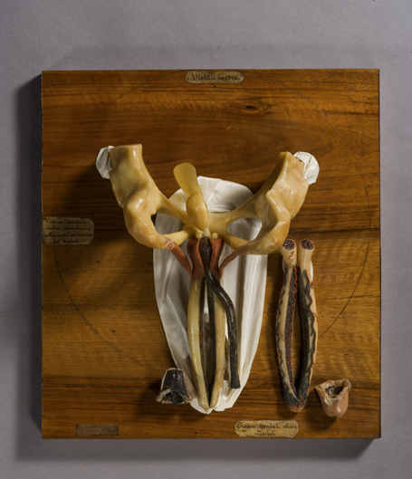 Dissezione degli organi genitali maschili, Modello anatomico (modello anatomico, opera isolata) di Luigi Cantuù (laboratorio) - produzione torinese (metà XIX)