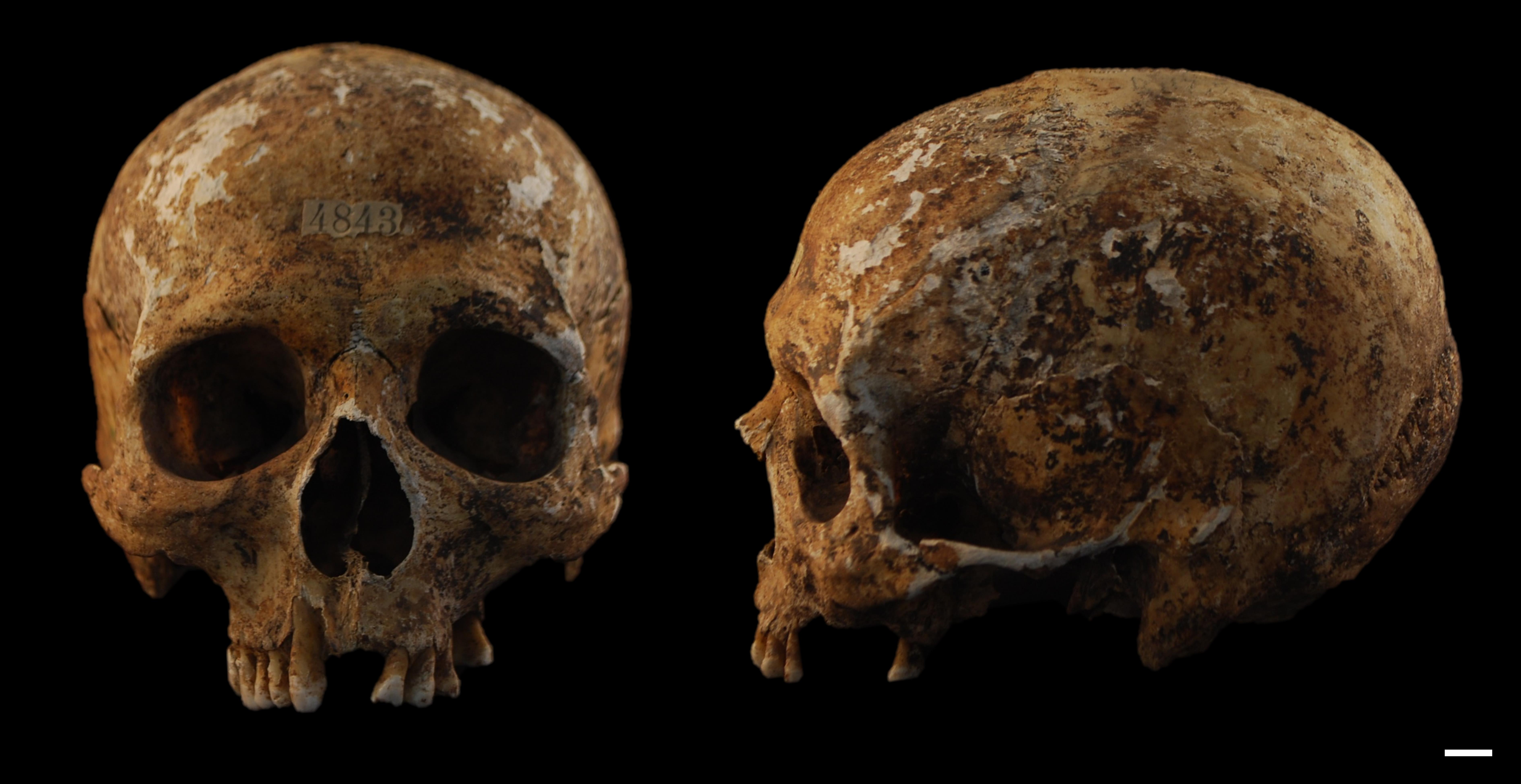 reperto osseo, cranio (morfologia naturale, inumato) - periodo attuale, siciliani (prima metà SECOLI/ XX)