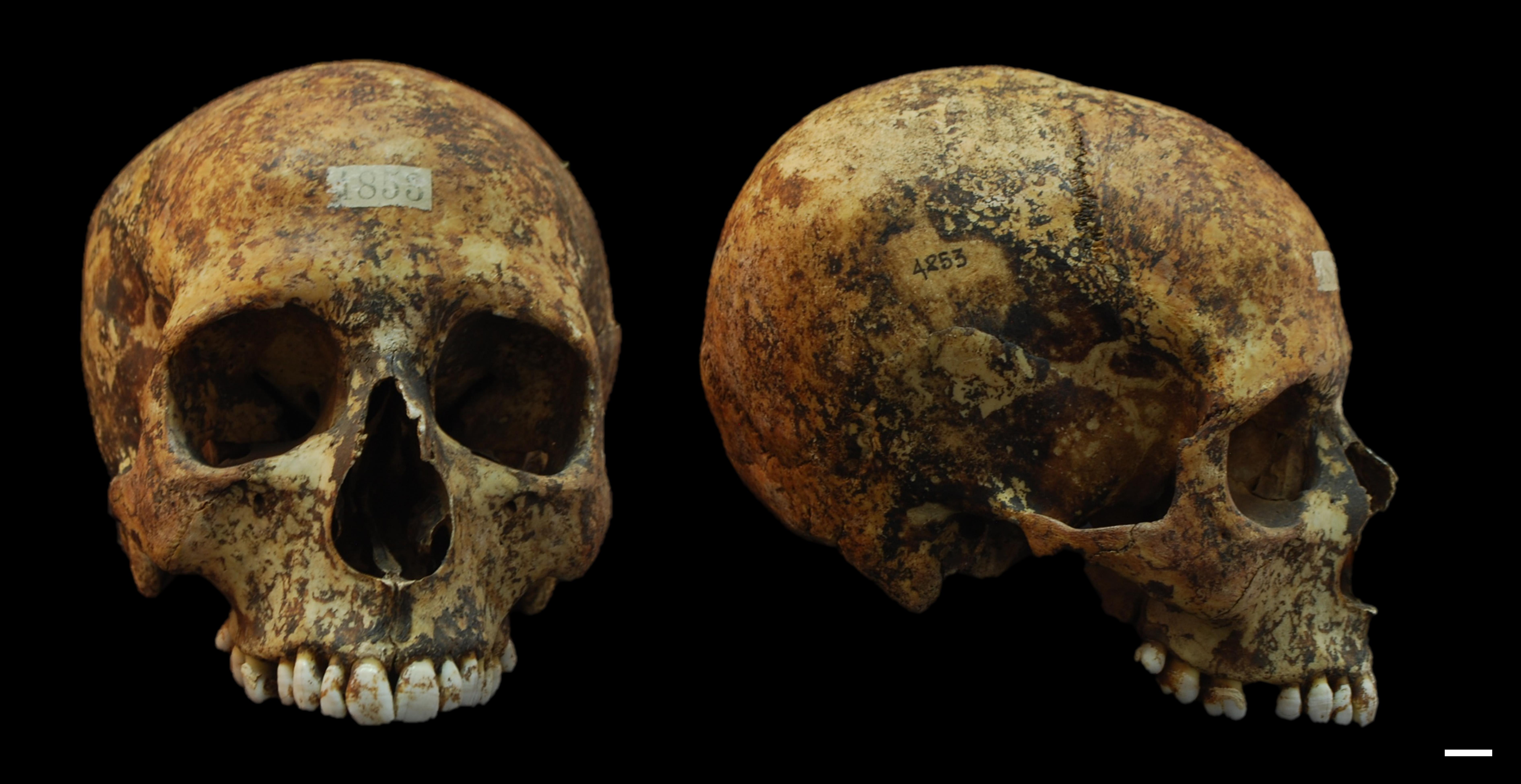 reperto osseo, cranio (morfologia naturale, inumato) - periodo attuale, siciliani (prima metà SECOLI/ XX)