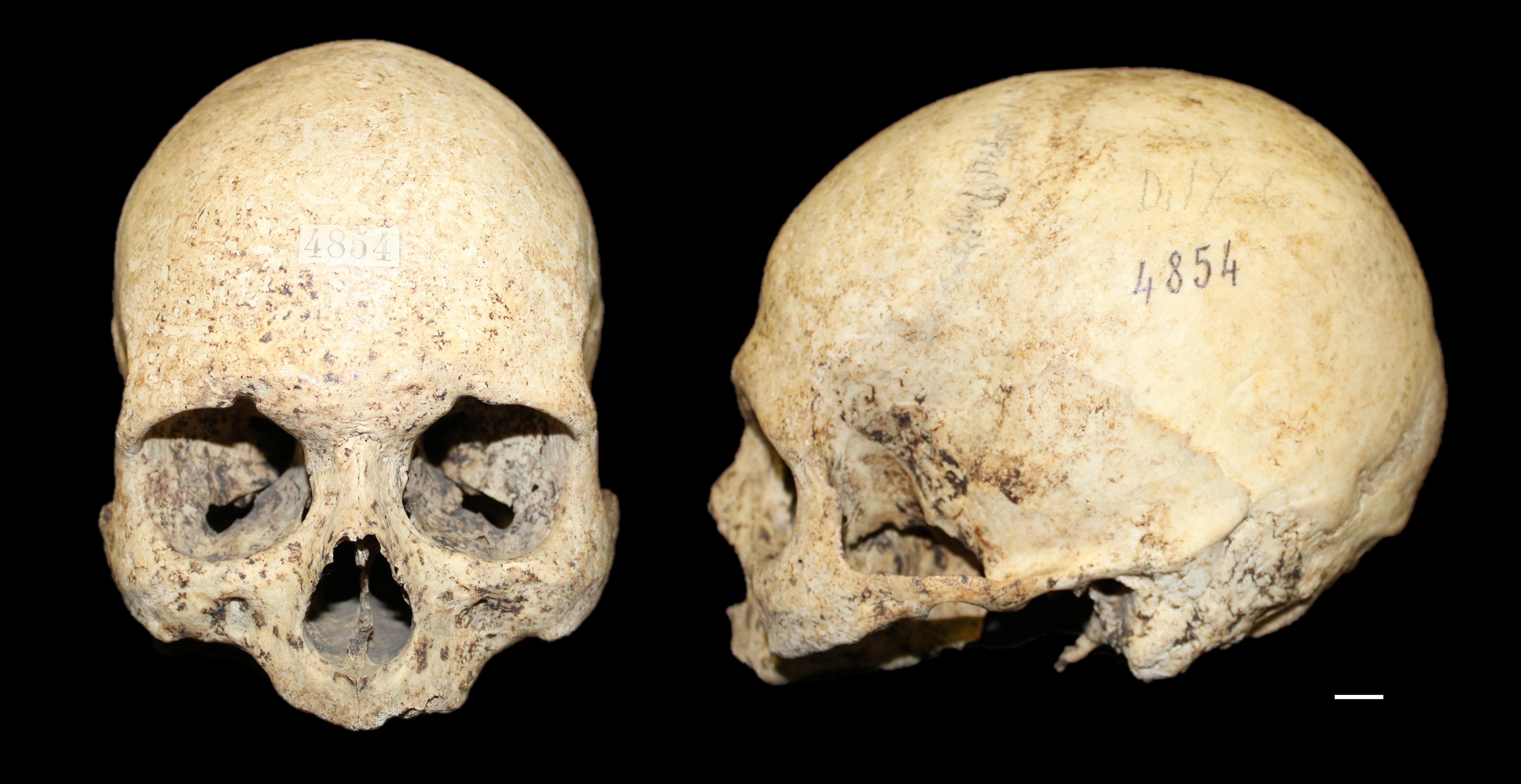 reperto osseo, cranio (morfologia naturale, inumato) - periodo attuale, siciliani (prima metà SECOLI/ XX)