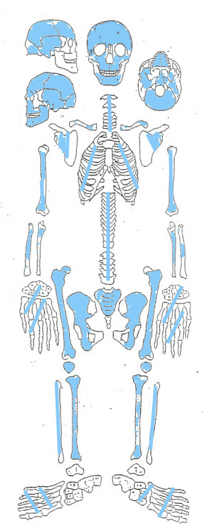 singolo reperto antropologico, reperto osteo-dentario (morfologia naturale, inumato) (PERIODIZZAZIONI/ STORIA/ Età antica/ Età tardoantica)