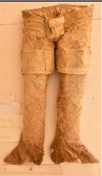 brache, infantile (prima metà XVI)